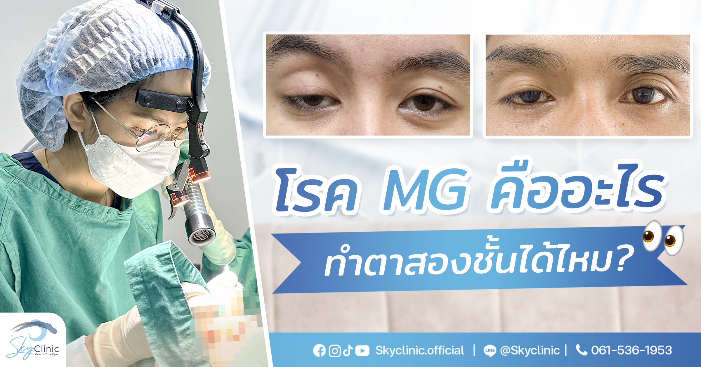 โรค MG คืออะไ