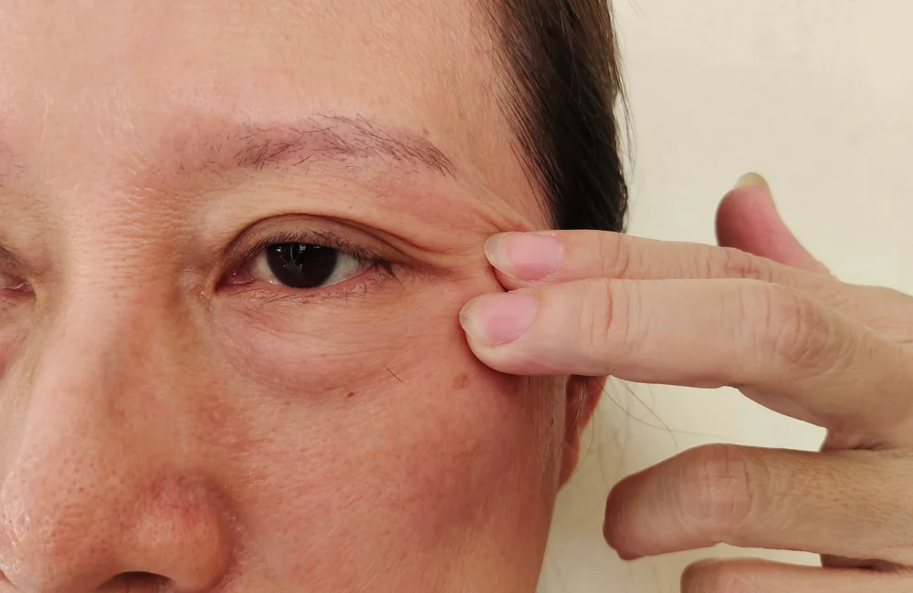 Eye Bag Removal Solution