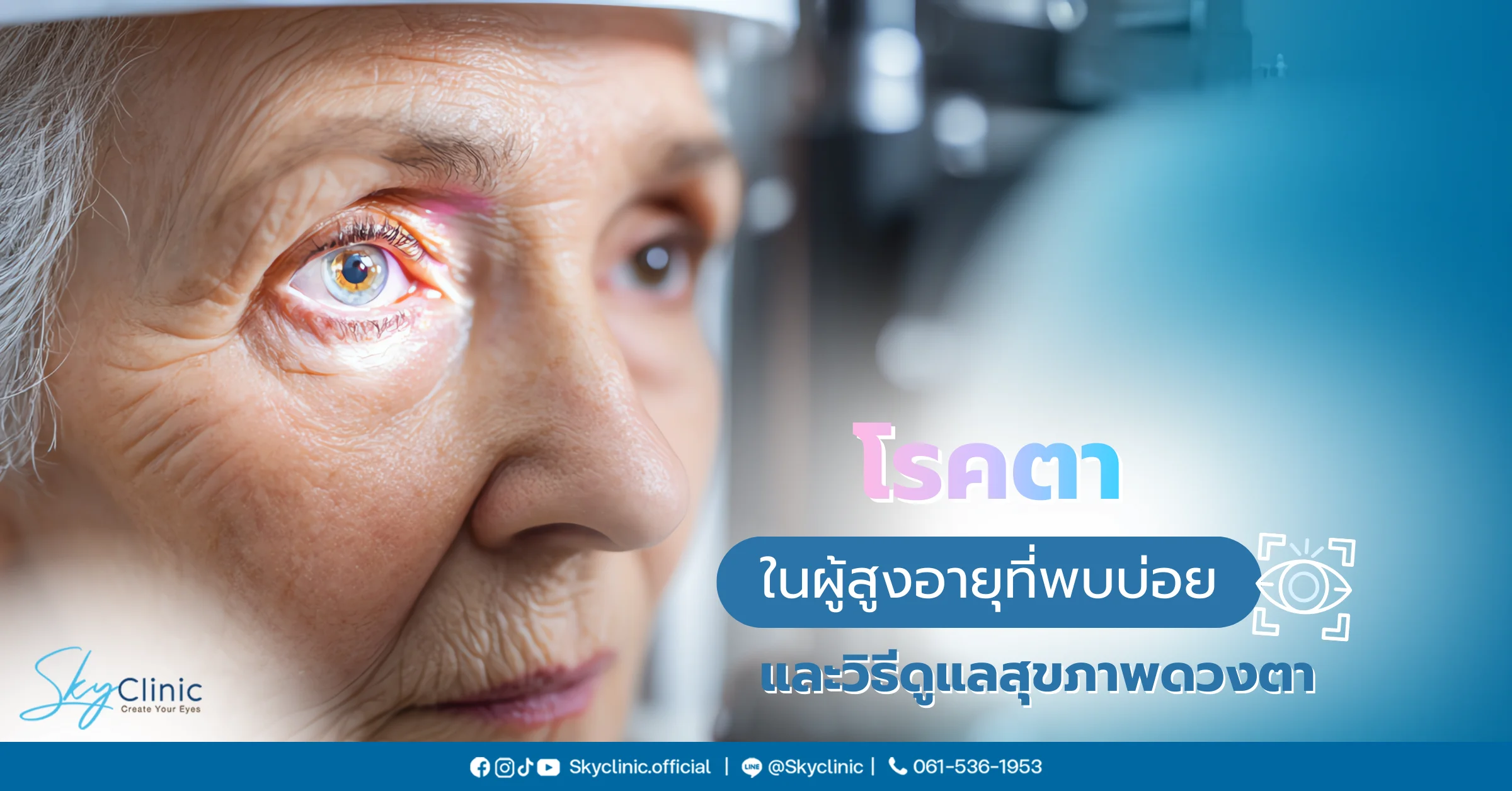 โรคตาในผู้สูงอายุที่พบบ่อย