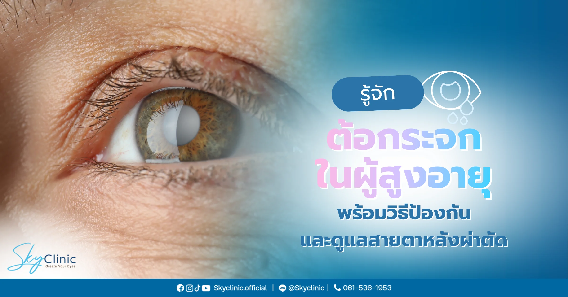 ต้อกระจกในผู้สูงอายุ