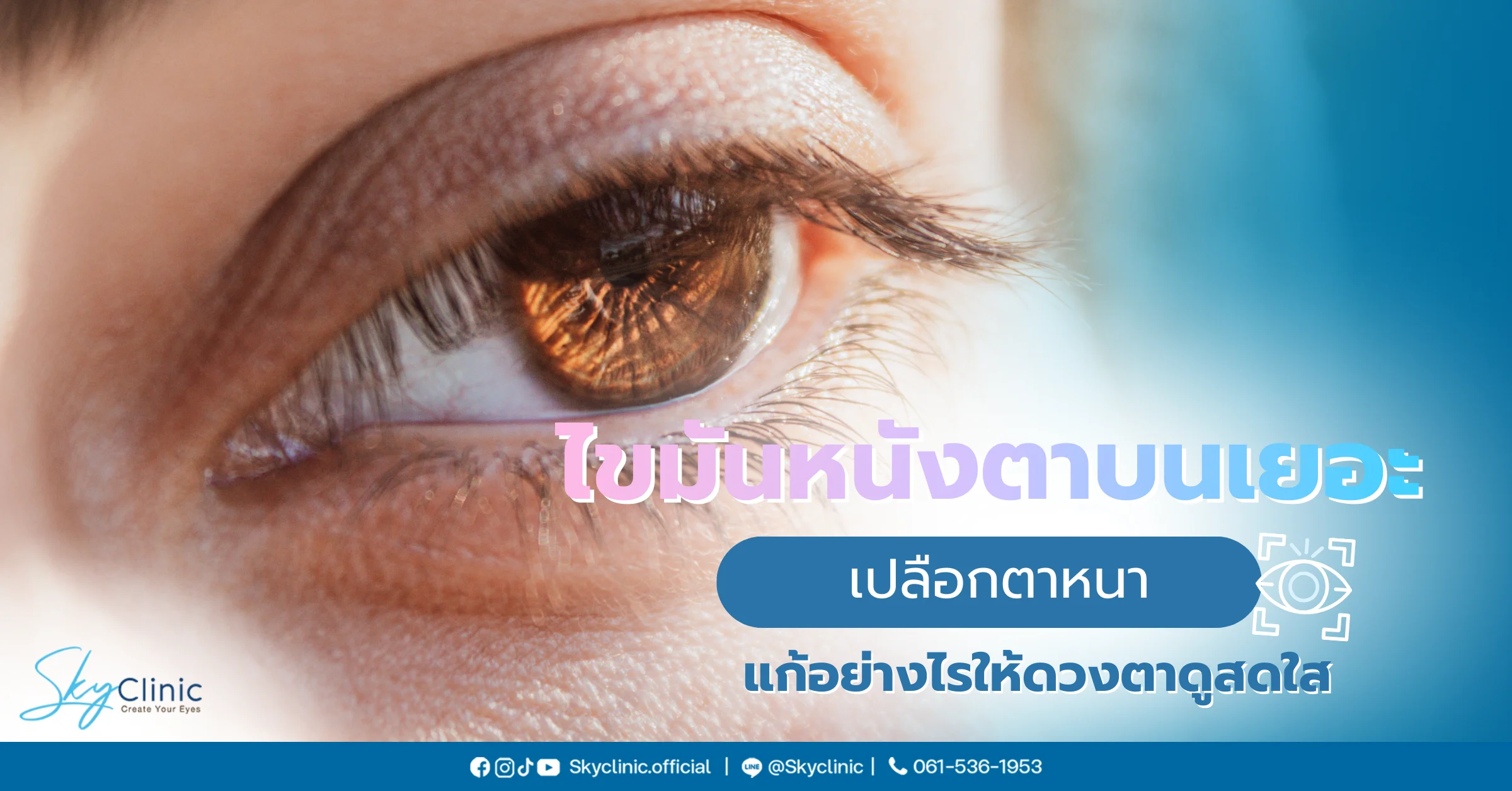  ไขมันหนังตาบนเยอะ