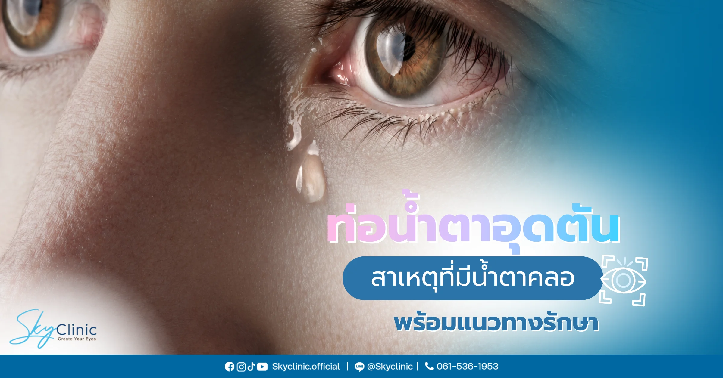  ท่อน้ำตาอุดตัน