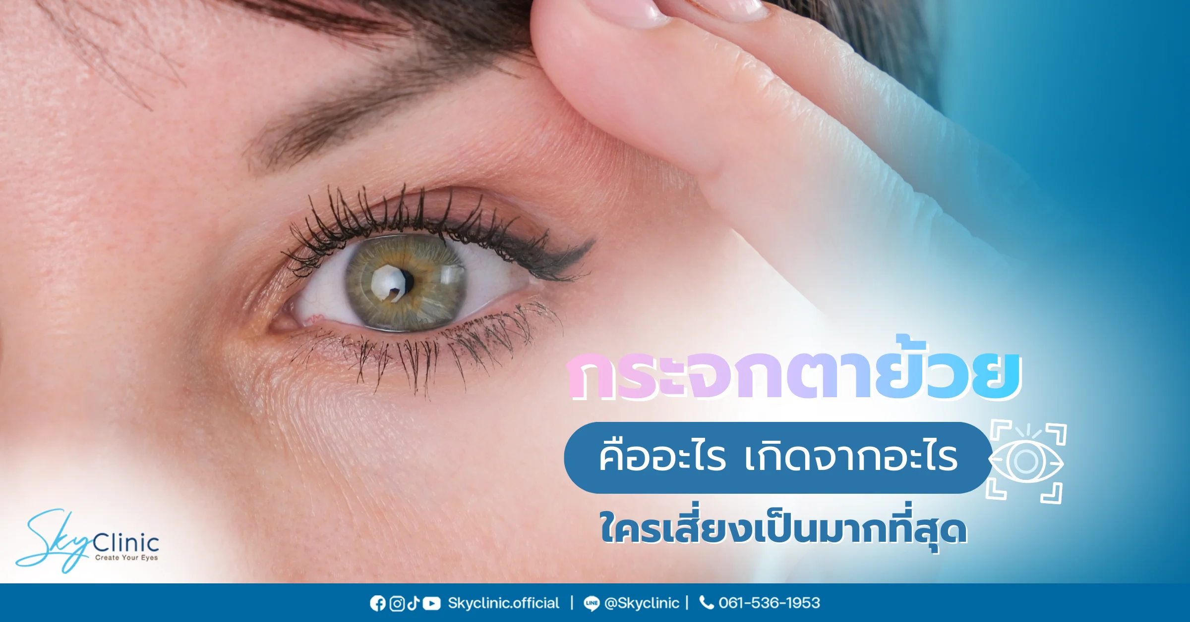 กระจกตาย้วย ภาวะผิดปกติทางสายตาที่เป็นอันตรายกว่าที่คิด