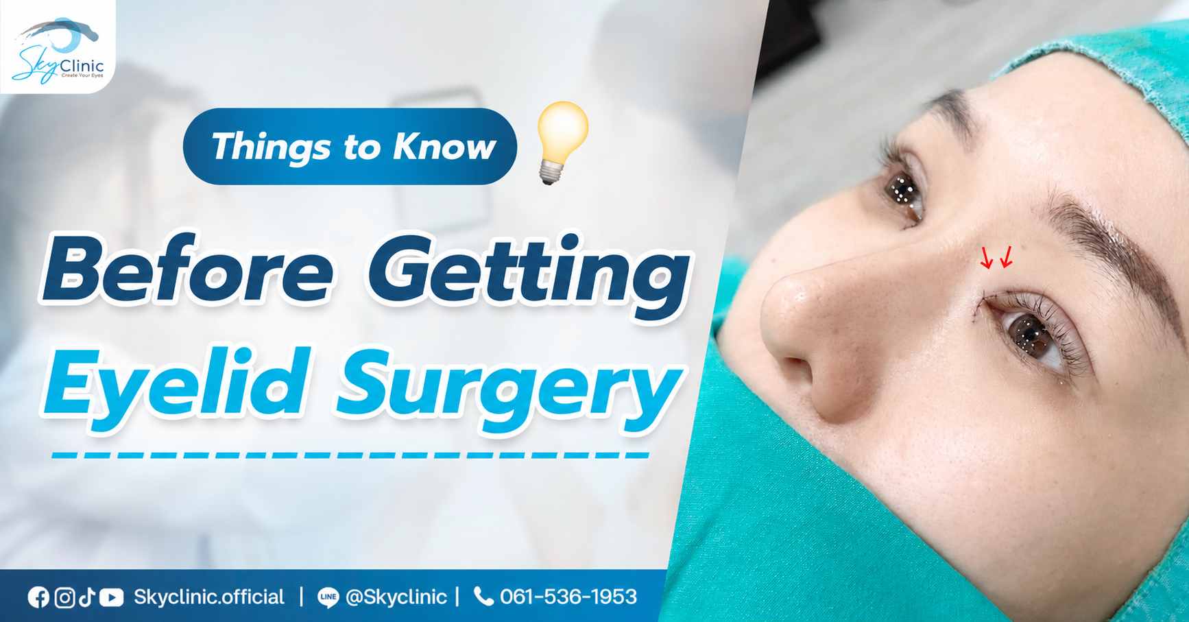 Things to know before deciding to open your eyes