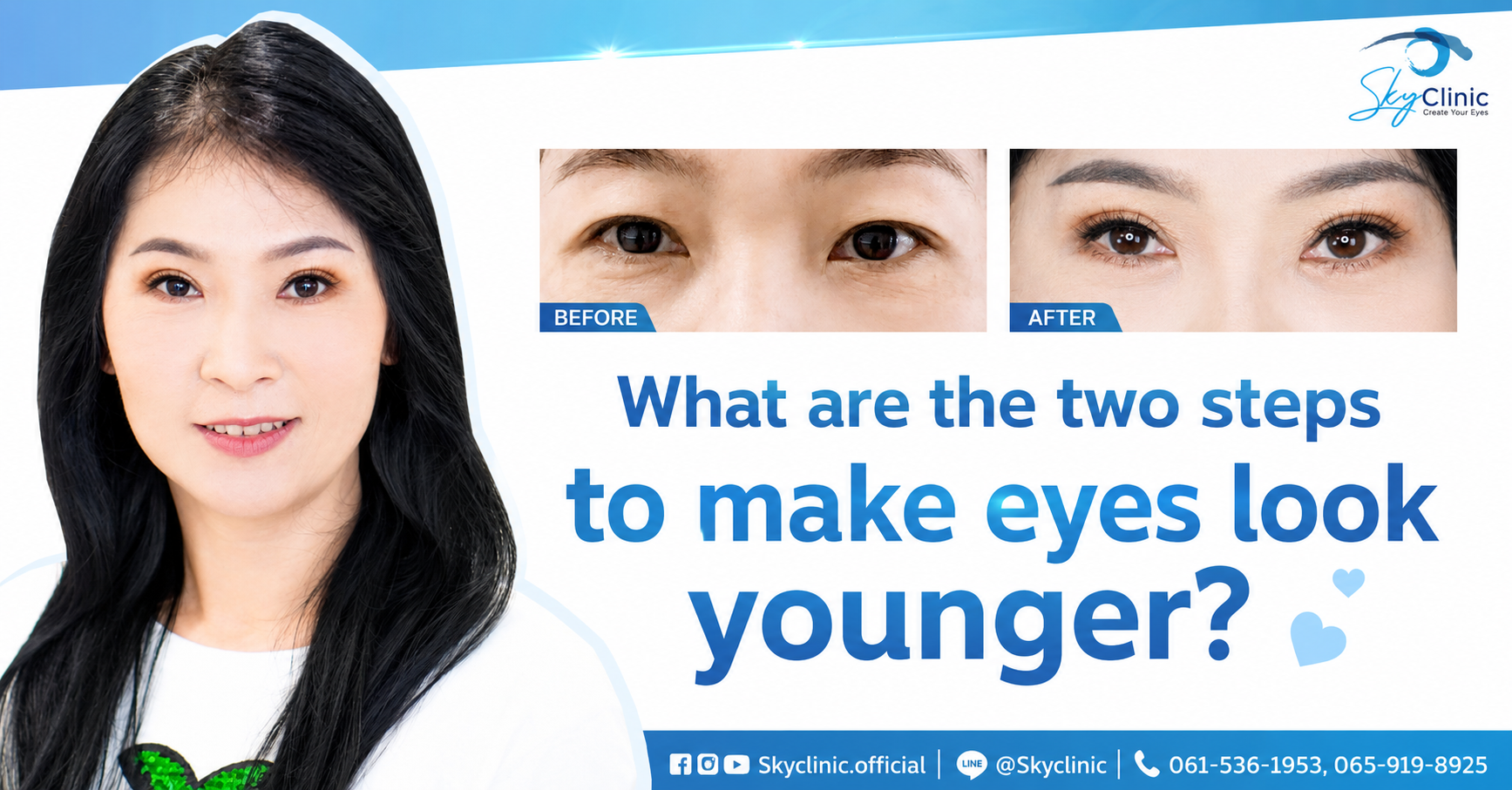 How to get double eyelid surgery for a more youthful look