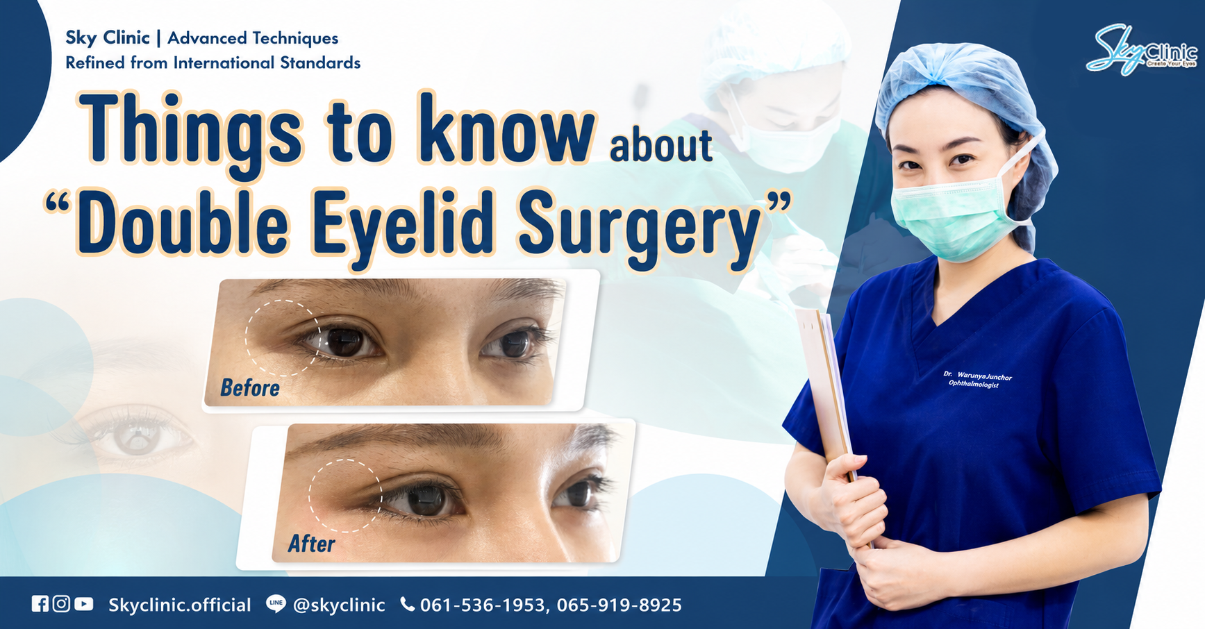Things you should know about eyelid surgery