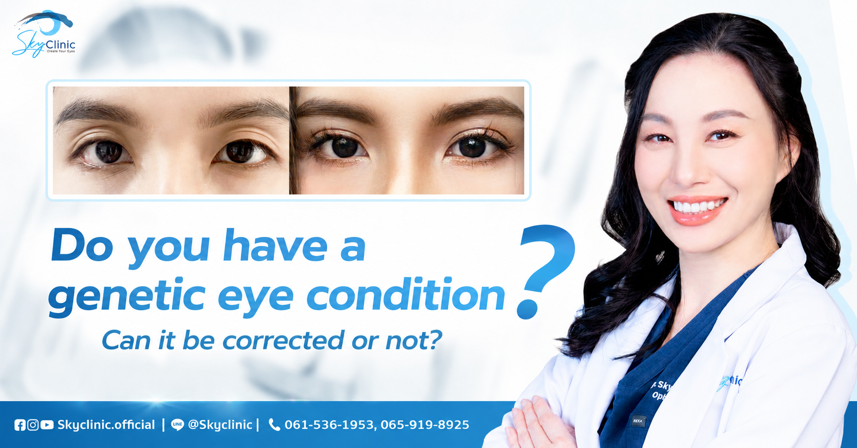 Double Eyelid Surgery with Underlying Medical Conditions: Important Considerations