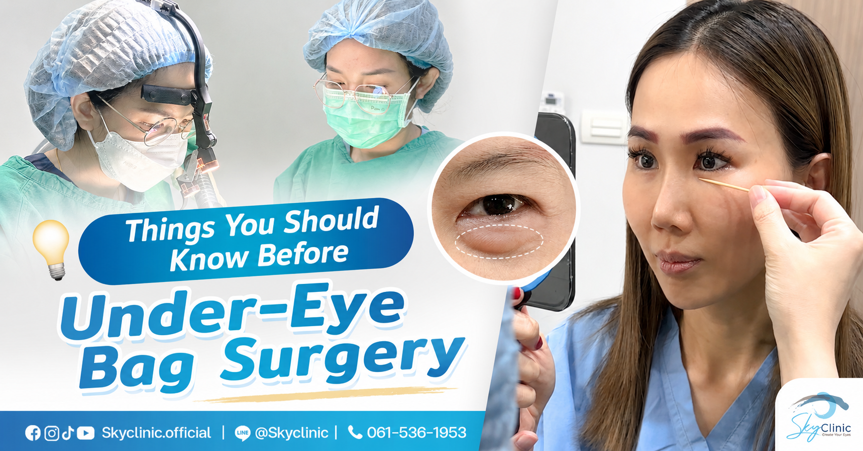 Things to Know Before Eyelid Surgery