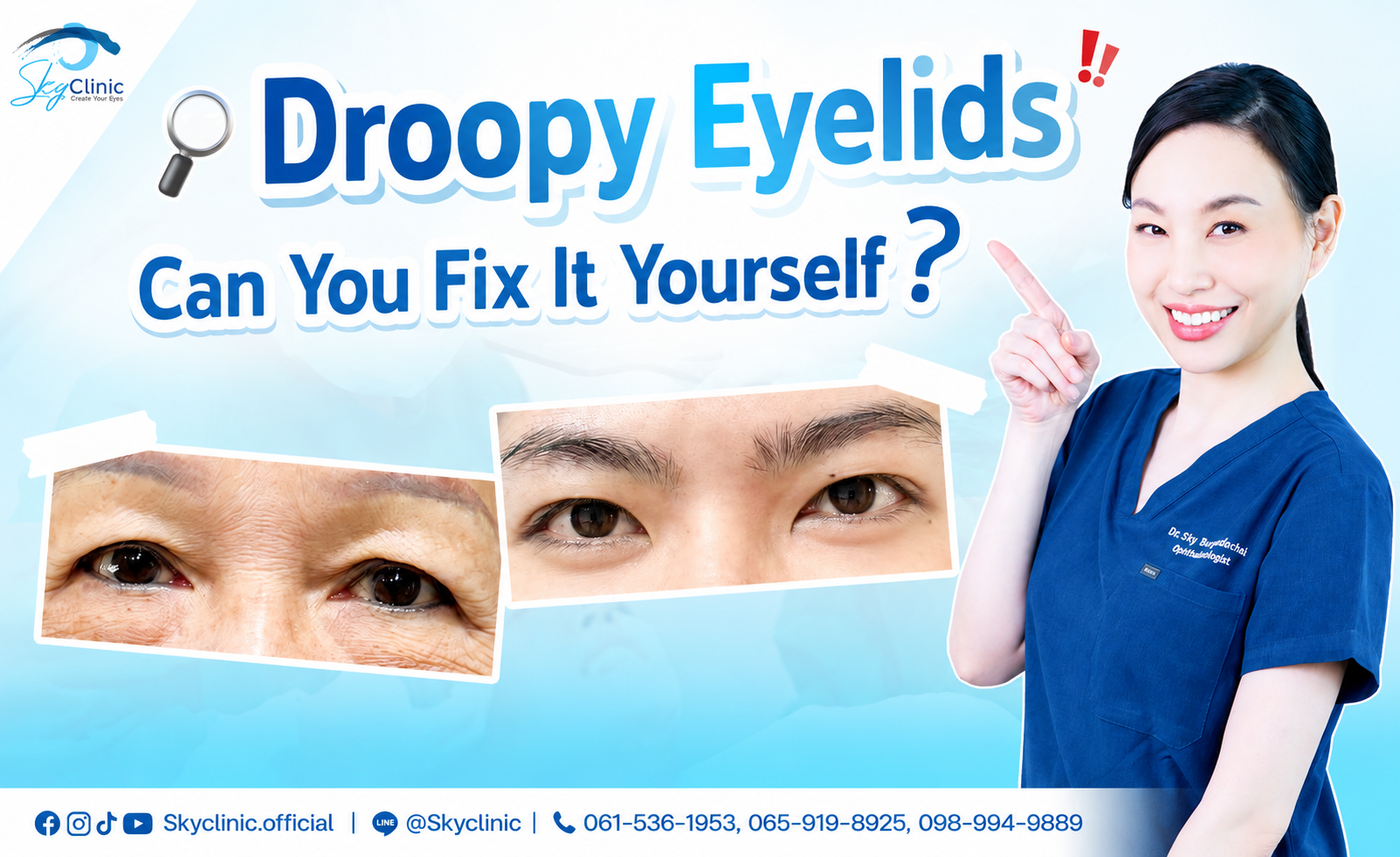 Can drooping eyelids heal on their own?