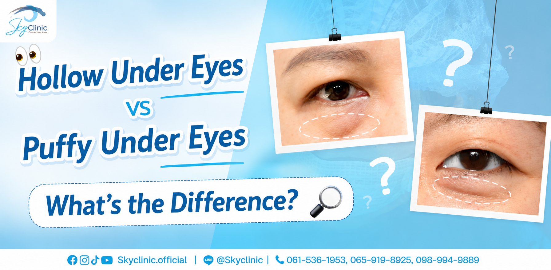 Real under eye bags VS fake under eye bags: What's the difference?