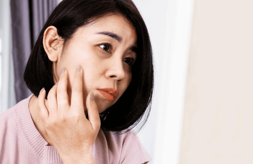Deep under-eye wrinkles can be easily treated naturally, eliminating worries about a tired-looking face.