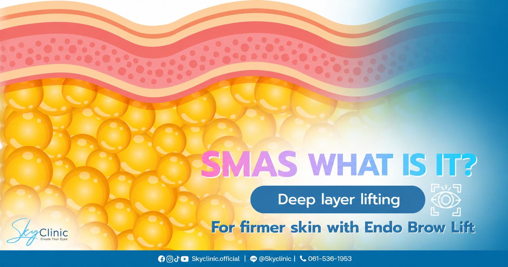 SMAS