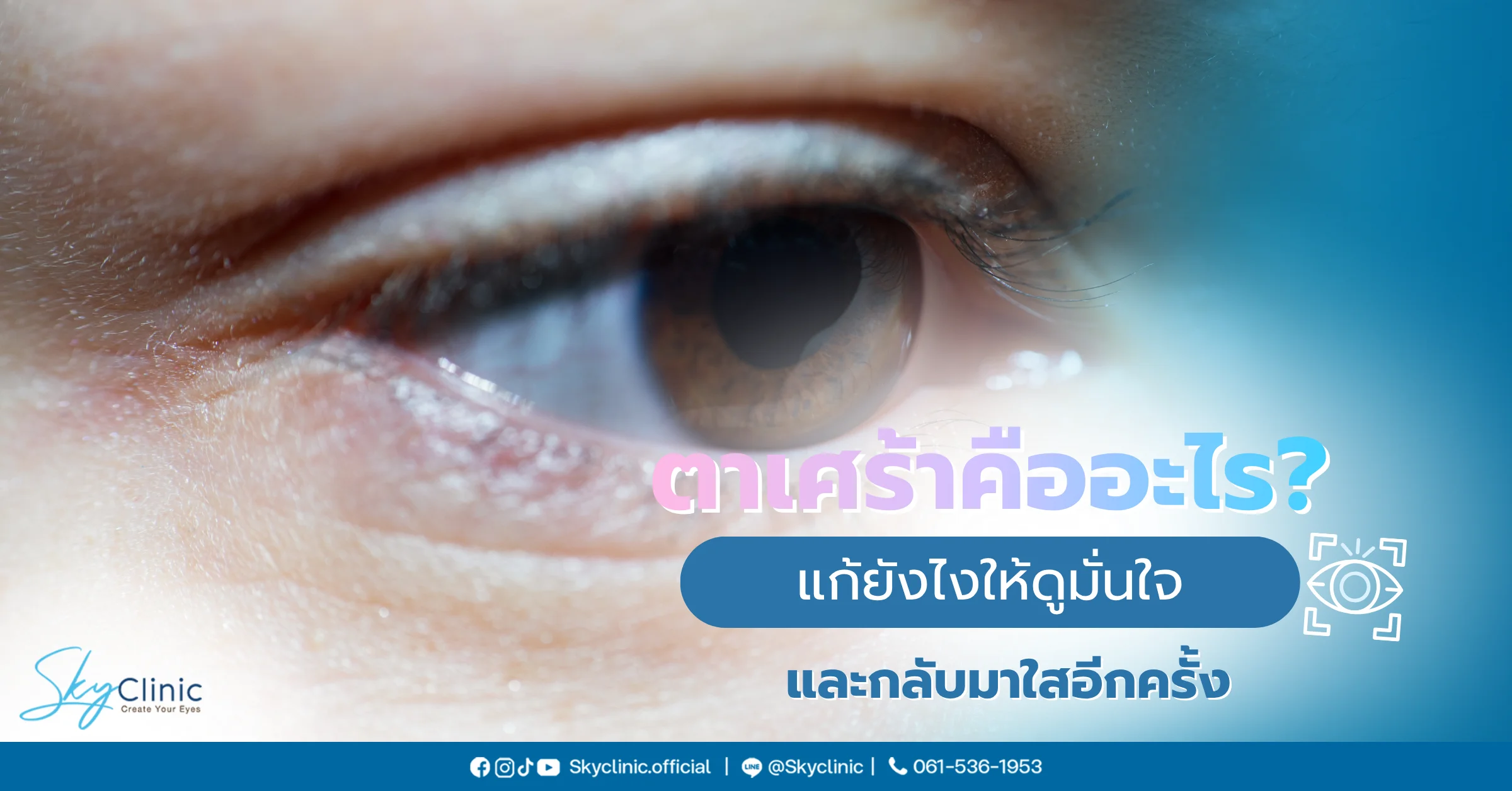 ตาเศร้า