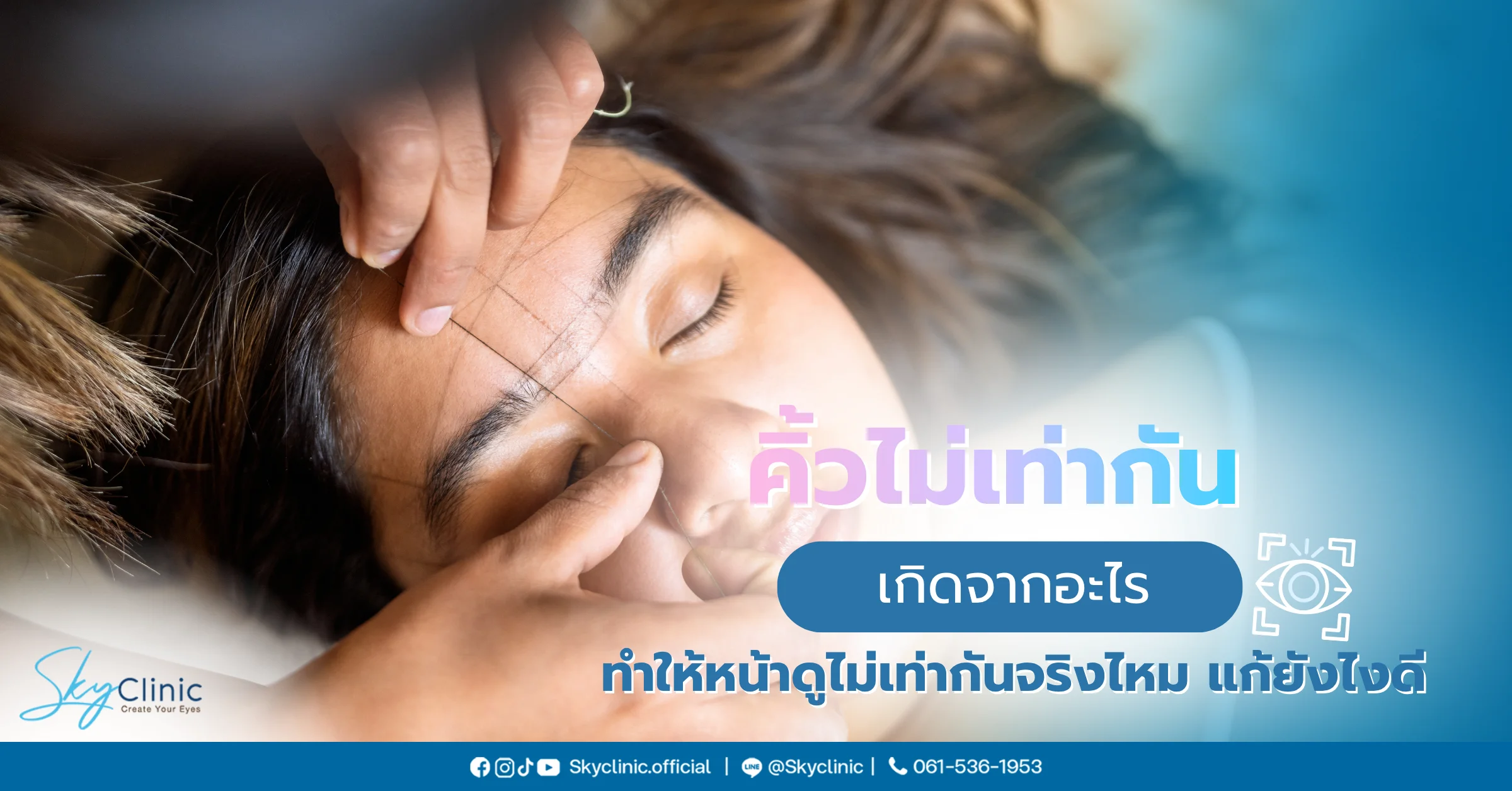 คิ้วไม่เท่ากัน