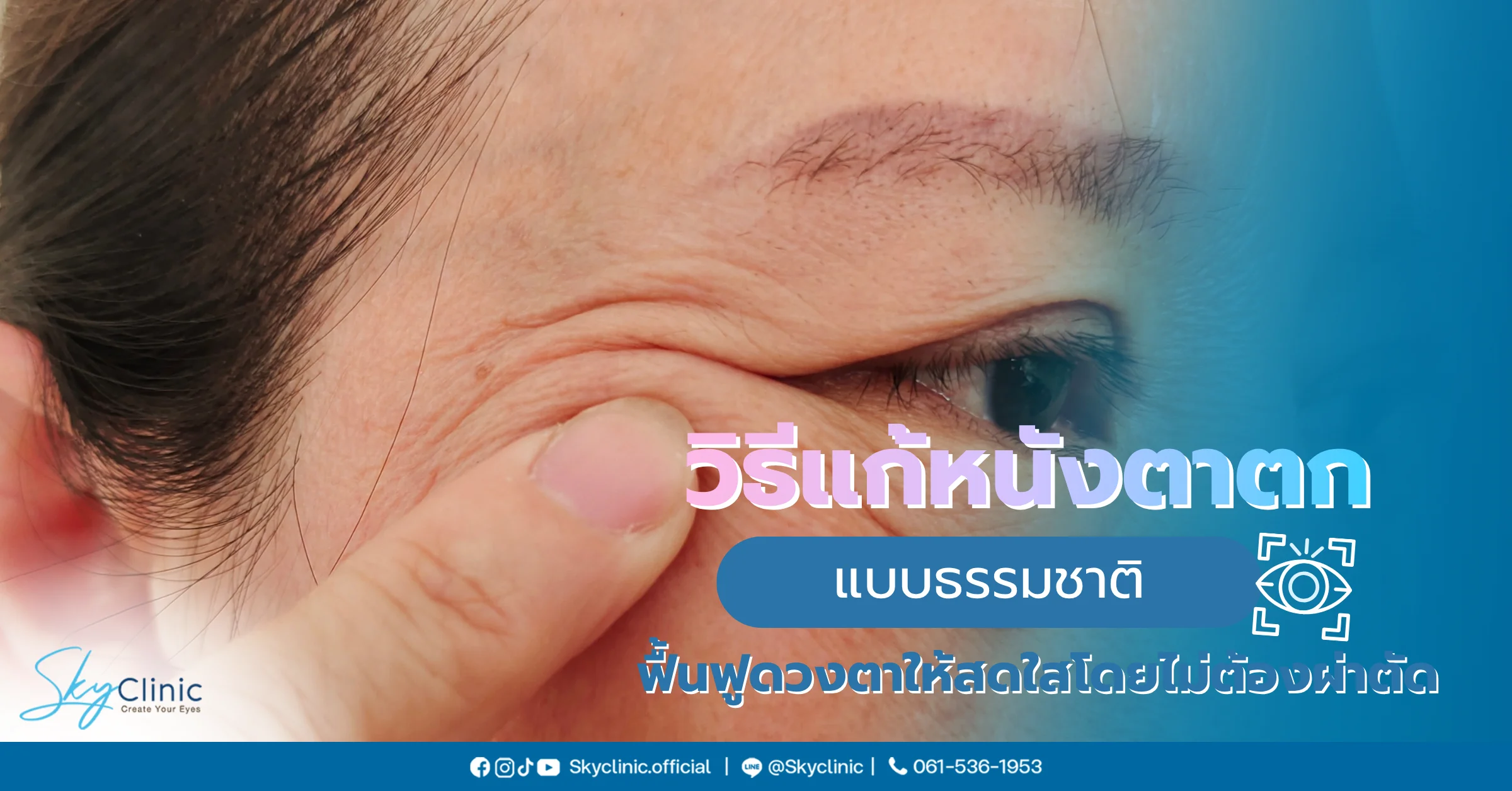 วิธีแก้หนังตาตก