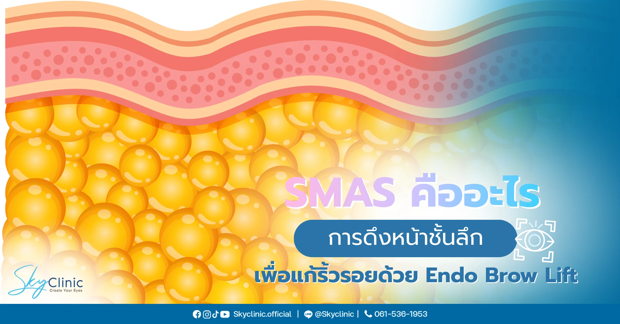 SMAS คืออะไร การดึงหน้าชั้นลึก เพื่อแก้ริ้วรอยด้วย Endobrow Lift