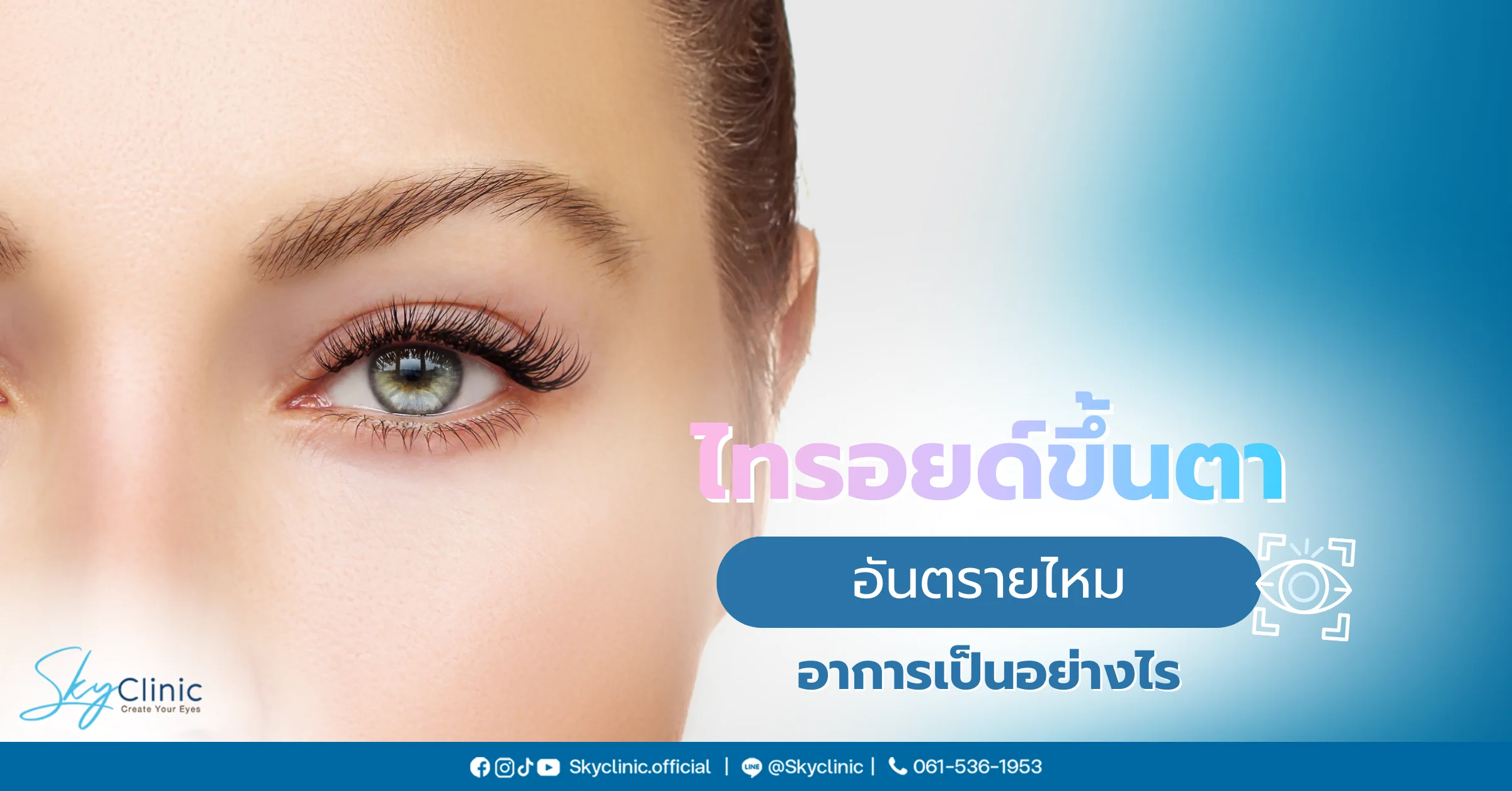 ไทรอยด์ขึ้นตา อาการ