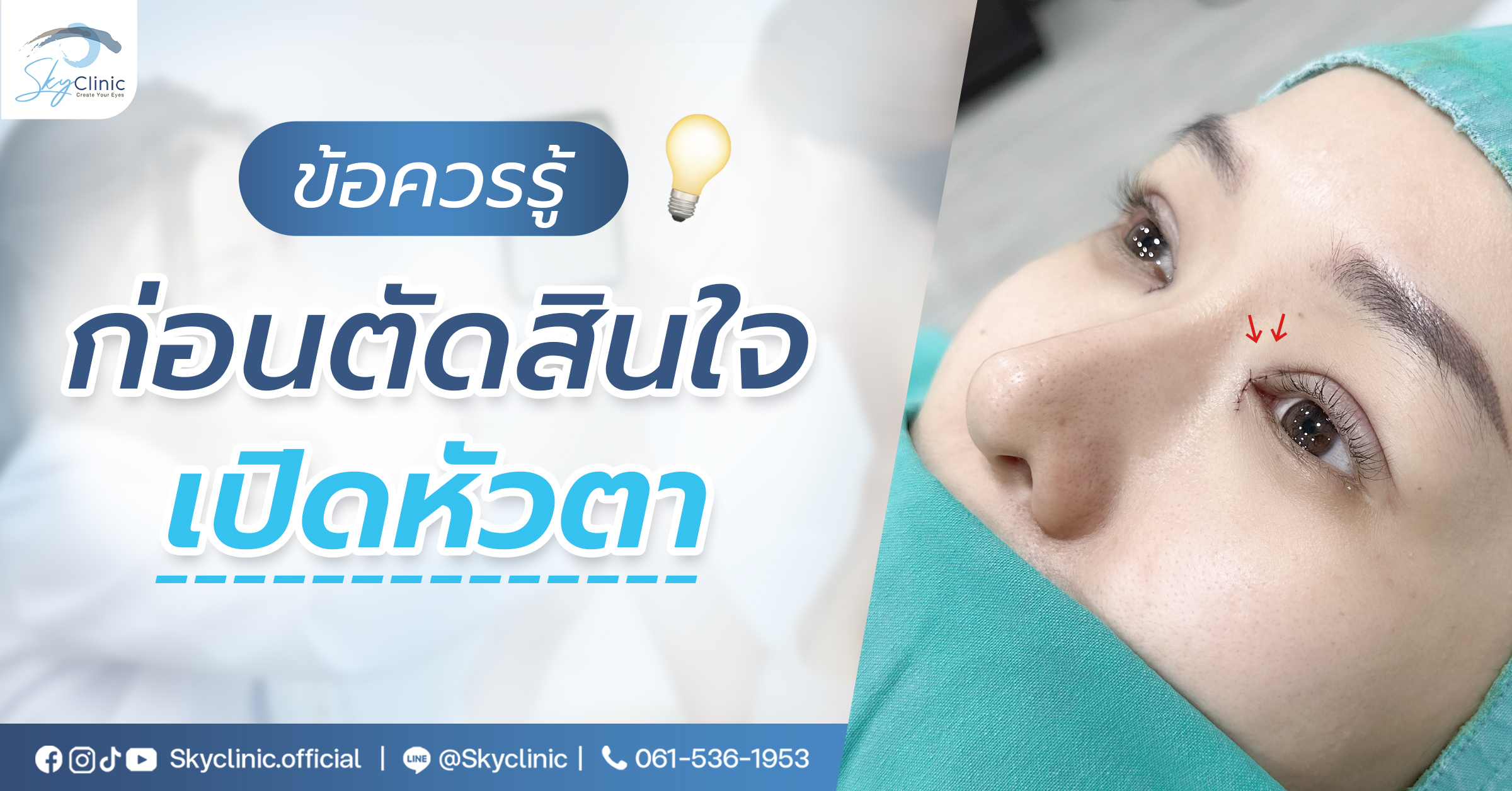 ข้อควรรู้ก่อนตัดสินใจเปิดหัวตา