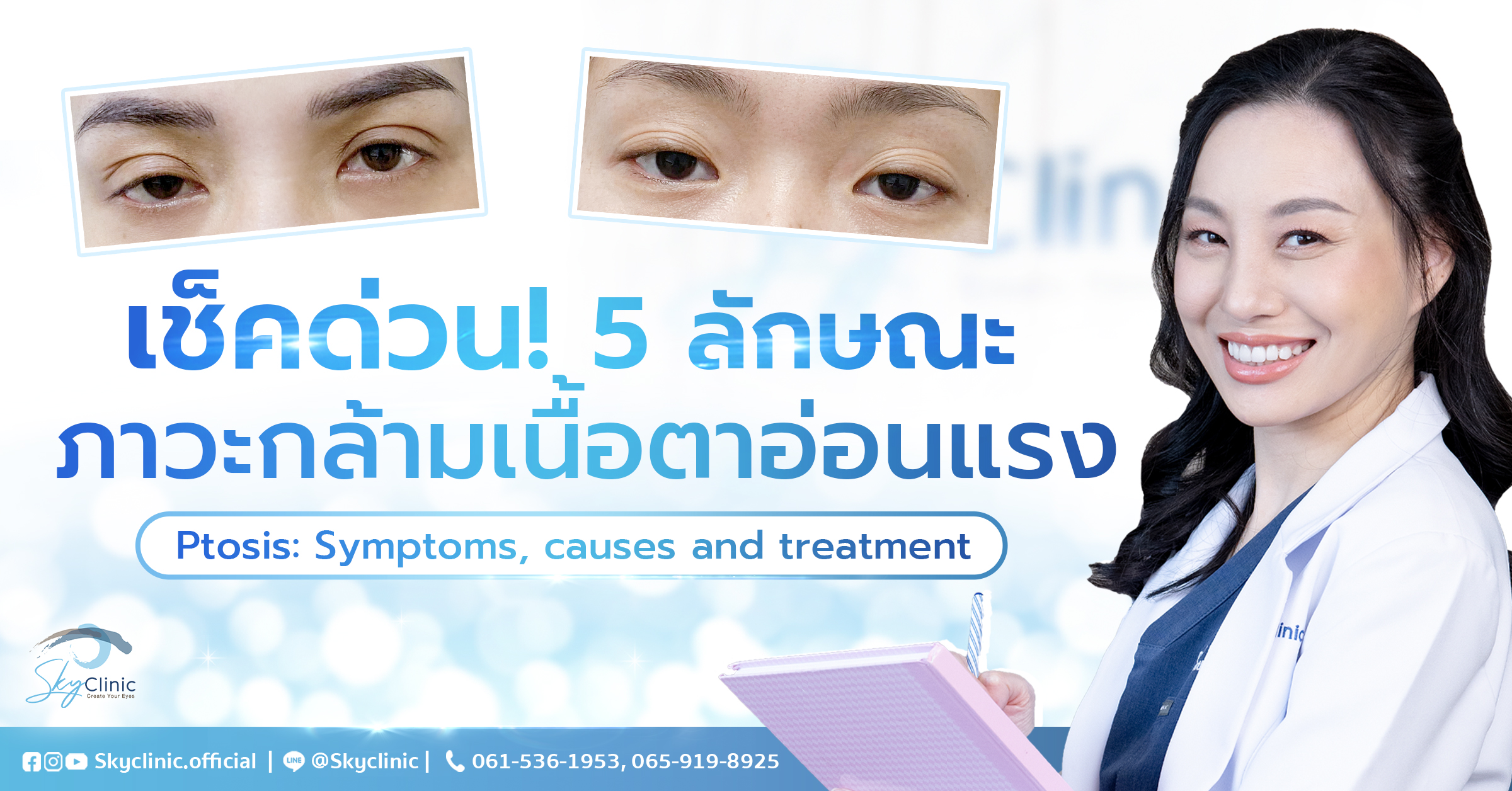เช็กด่วน! 5 ลักษณะภาวะกล้ามเนื้อตาอ่อนแรงเกิดจากอะไร