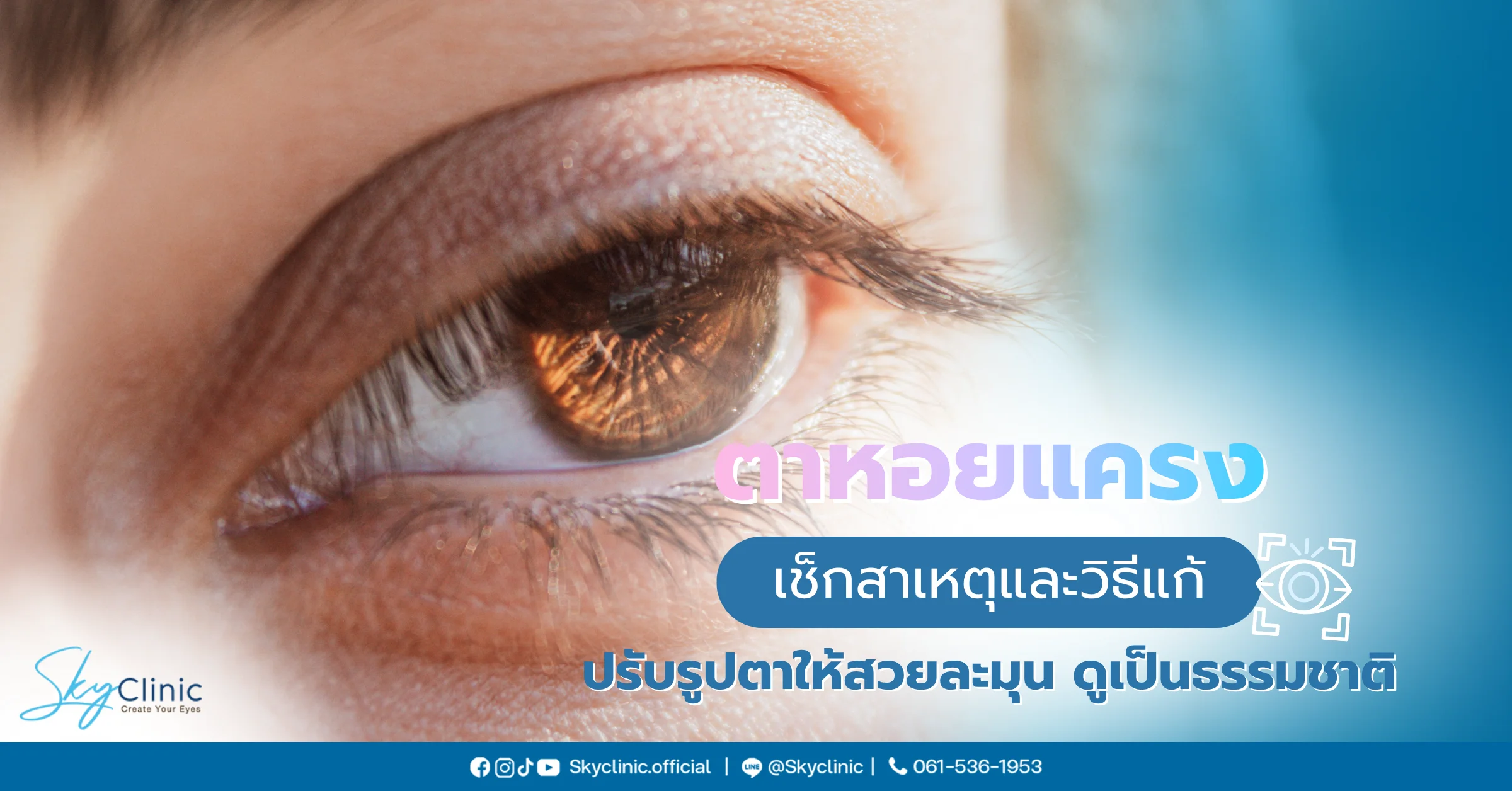 แก้ตาหอยแครง