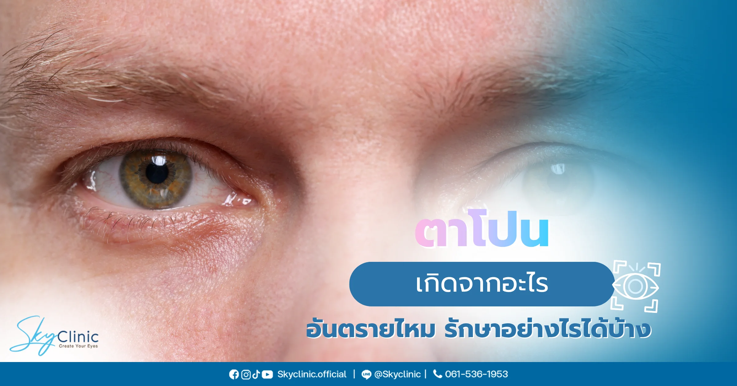 ตาโปน