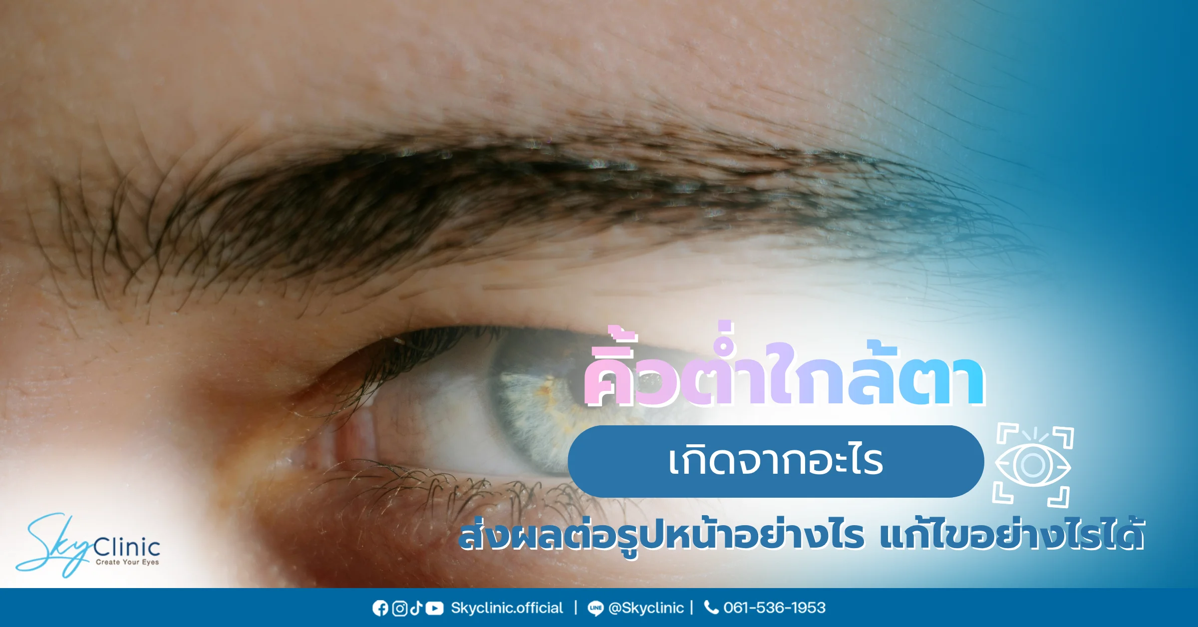 คิ้วต่ำใกล้ตา