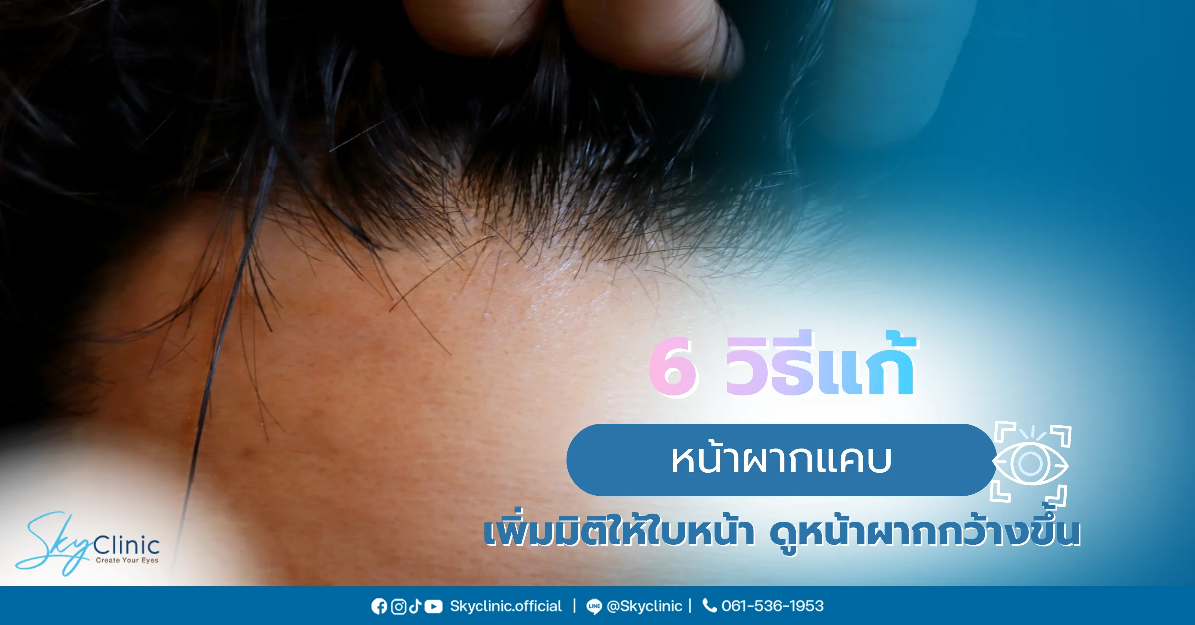หน้าผากแคบ