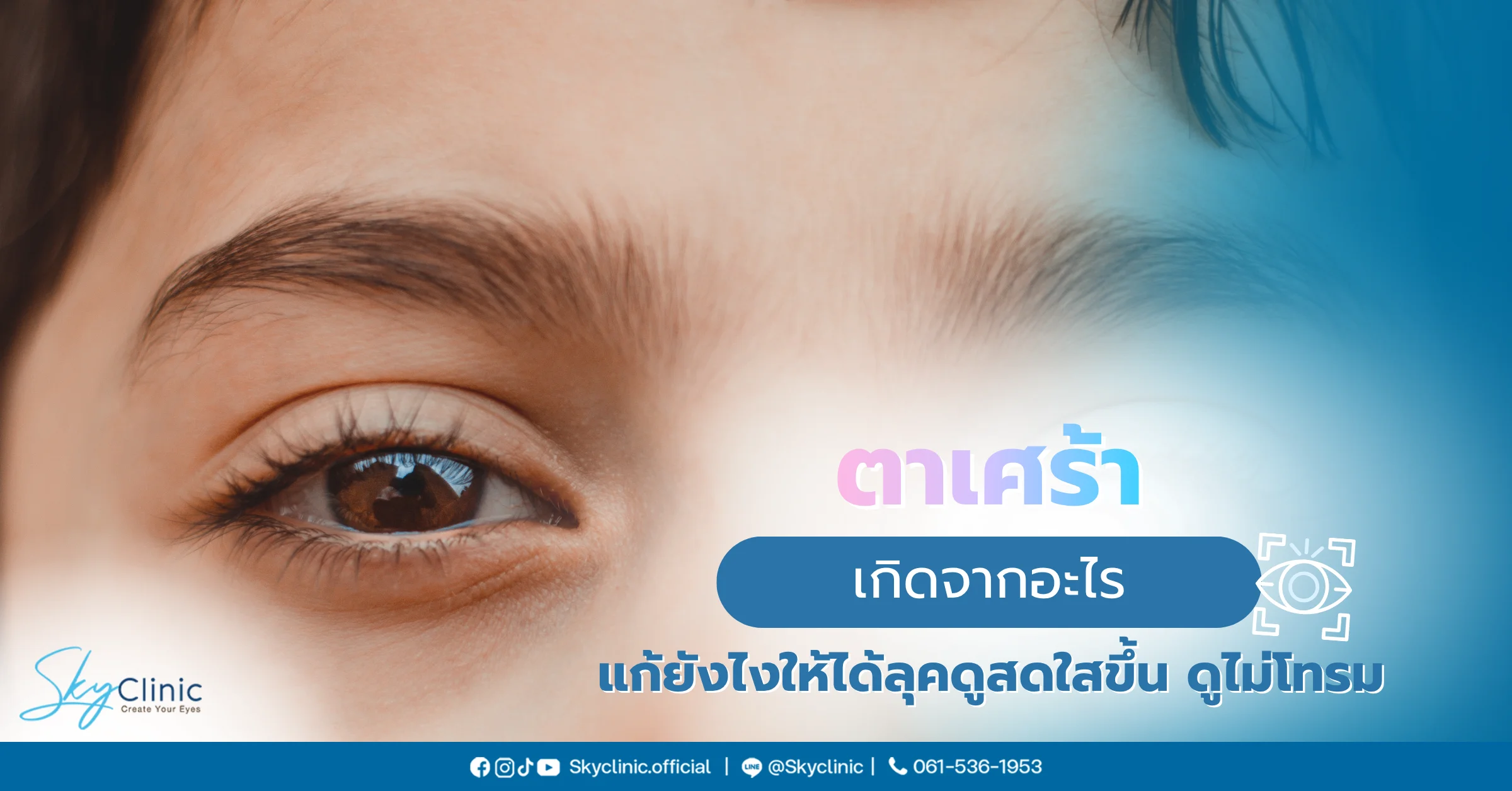 ตาเศร้า