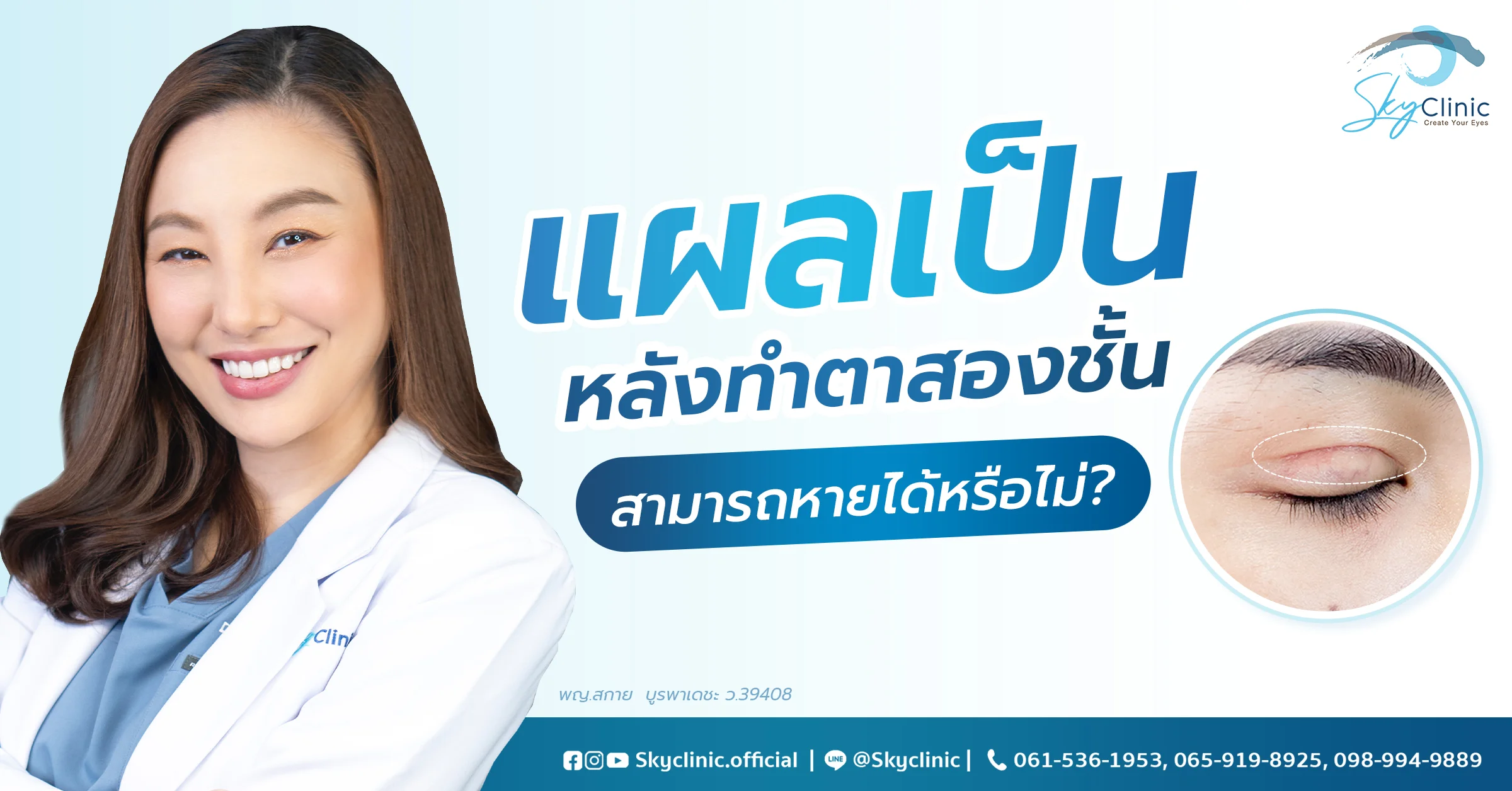 แผลเป็น แผลคีลอยด์ตาสองชั้นหายได้หรือไม่