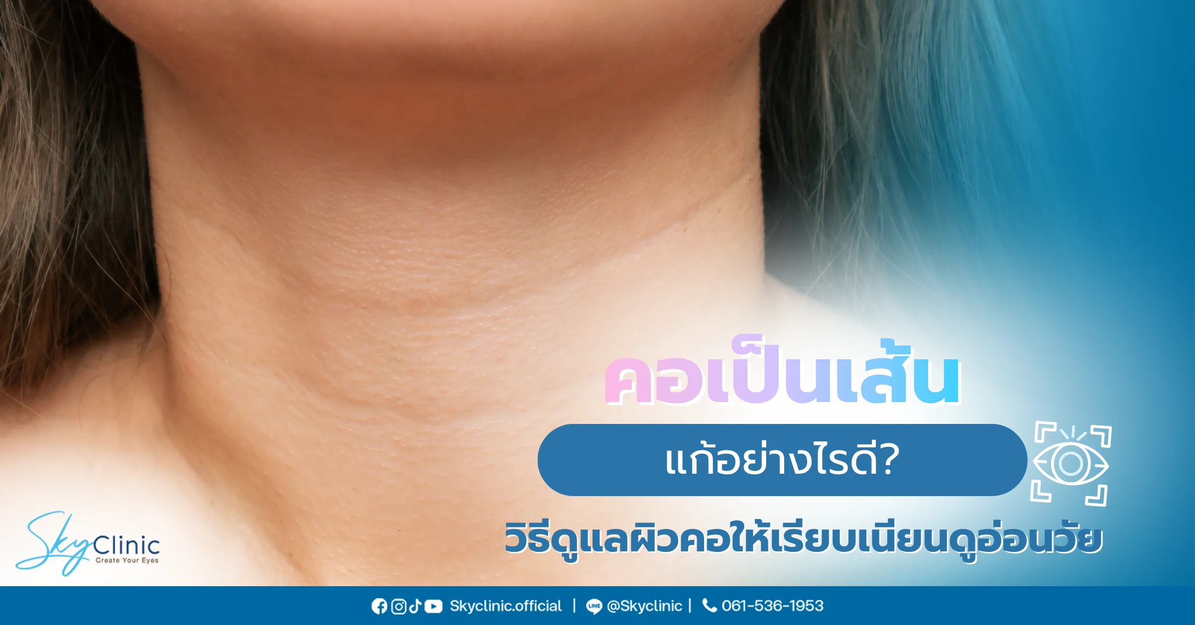 คอเป็นเส้น