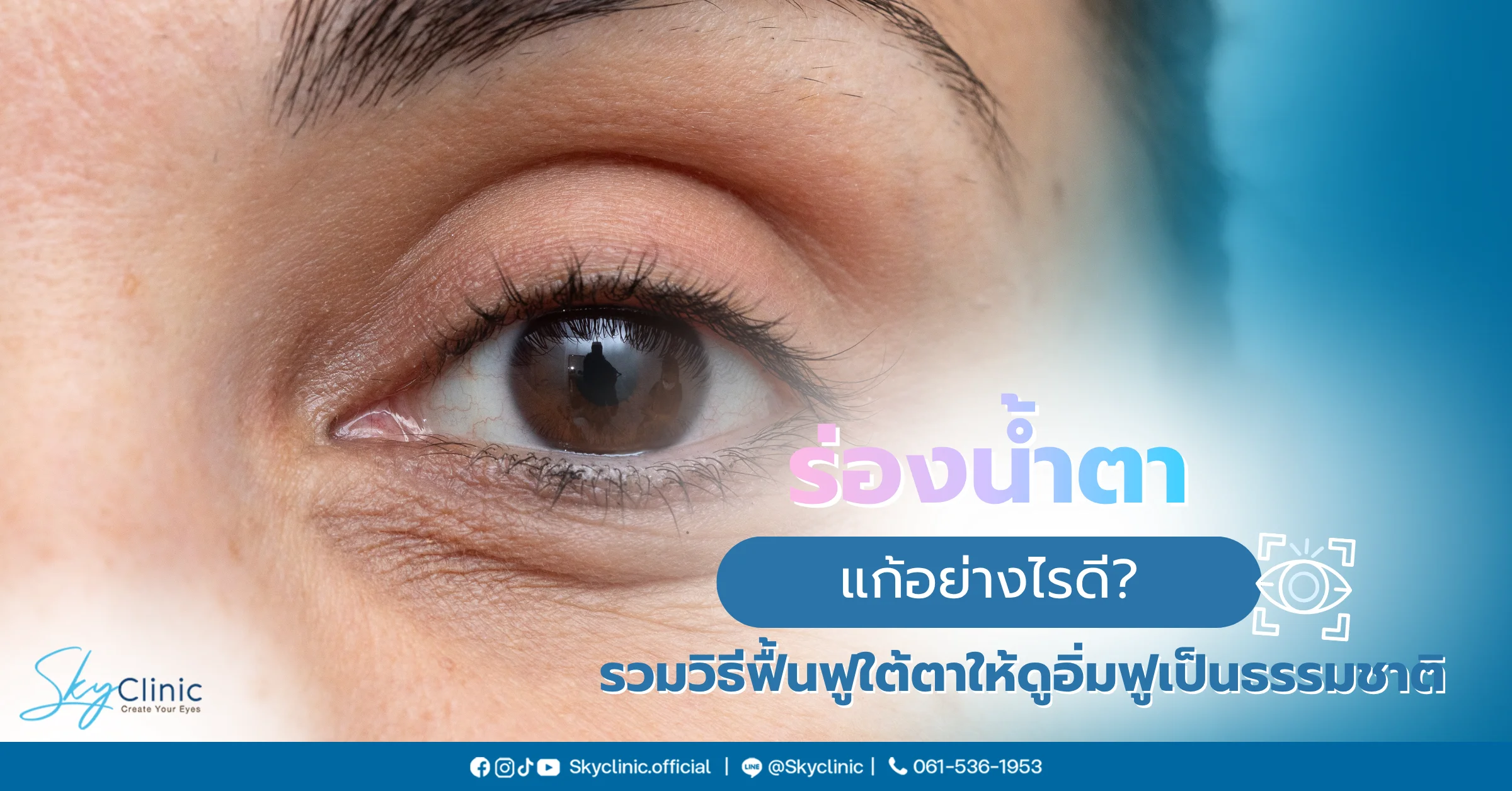 ร่องน้ำตา
