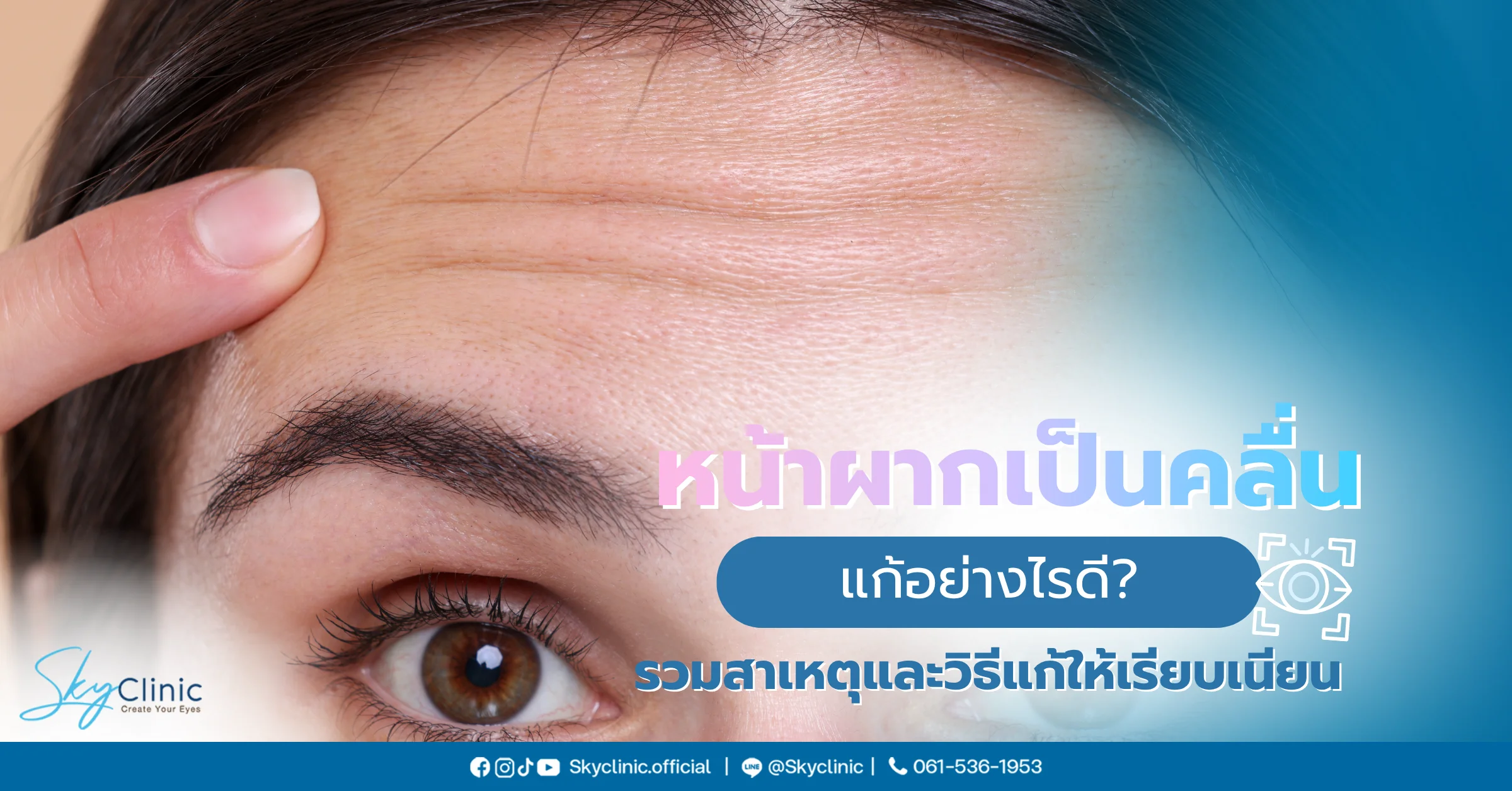 หน้าผากเป็นคลื่น