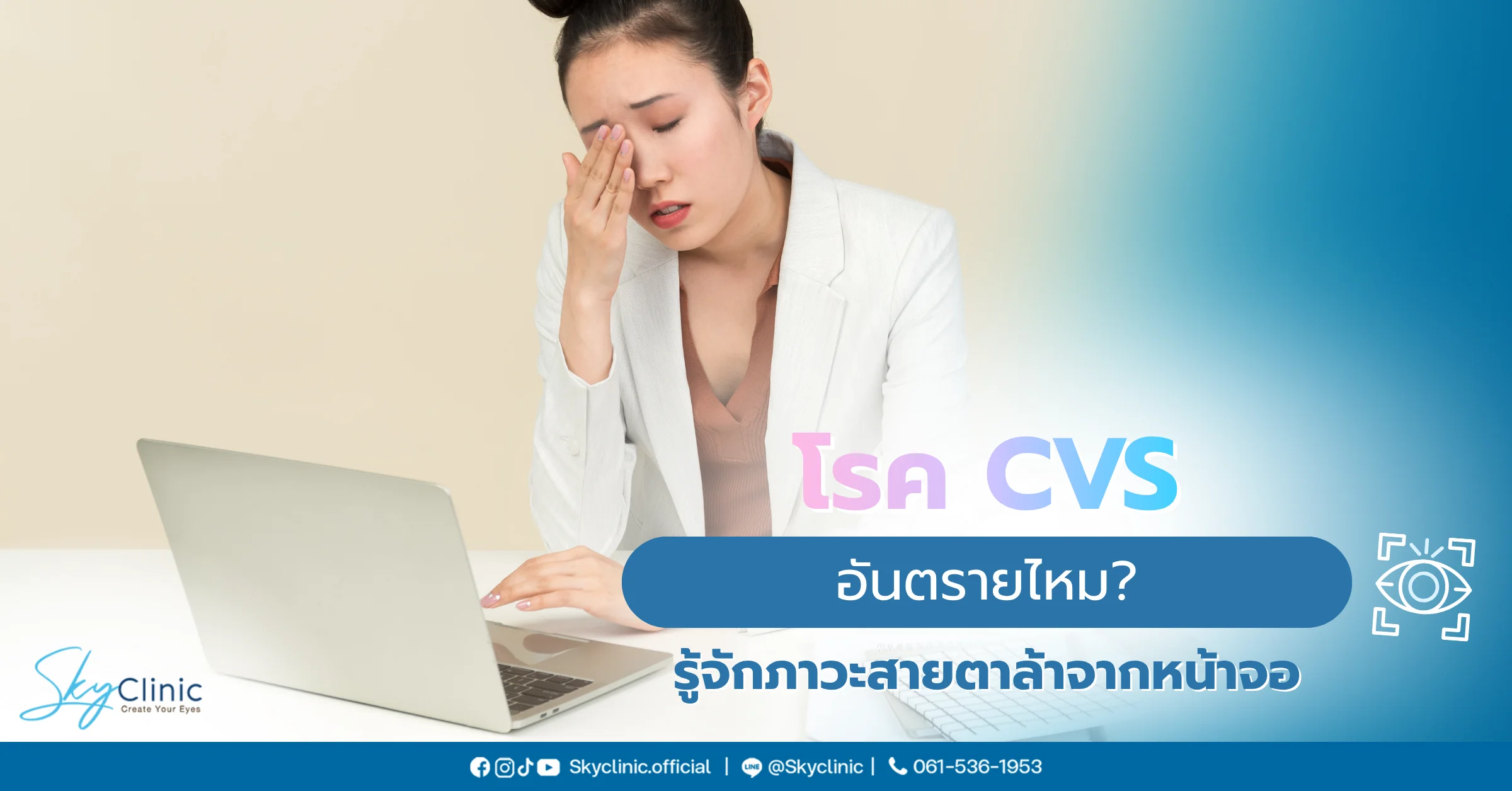 โรค CVS