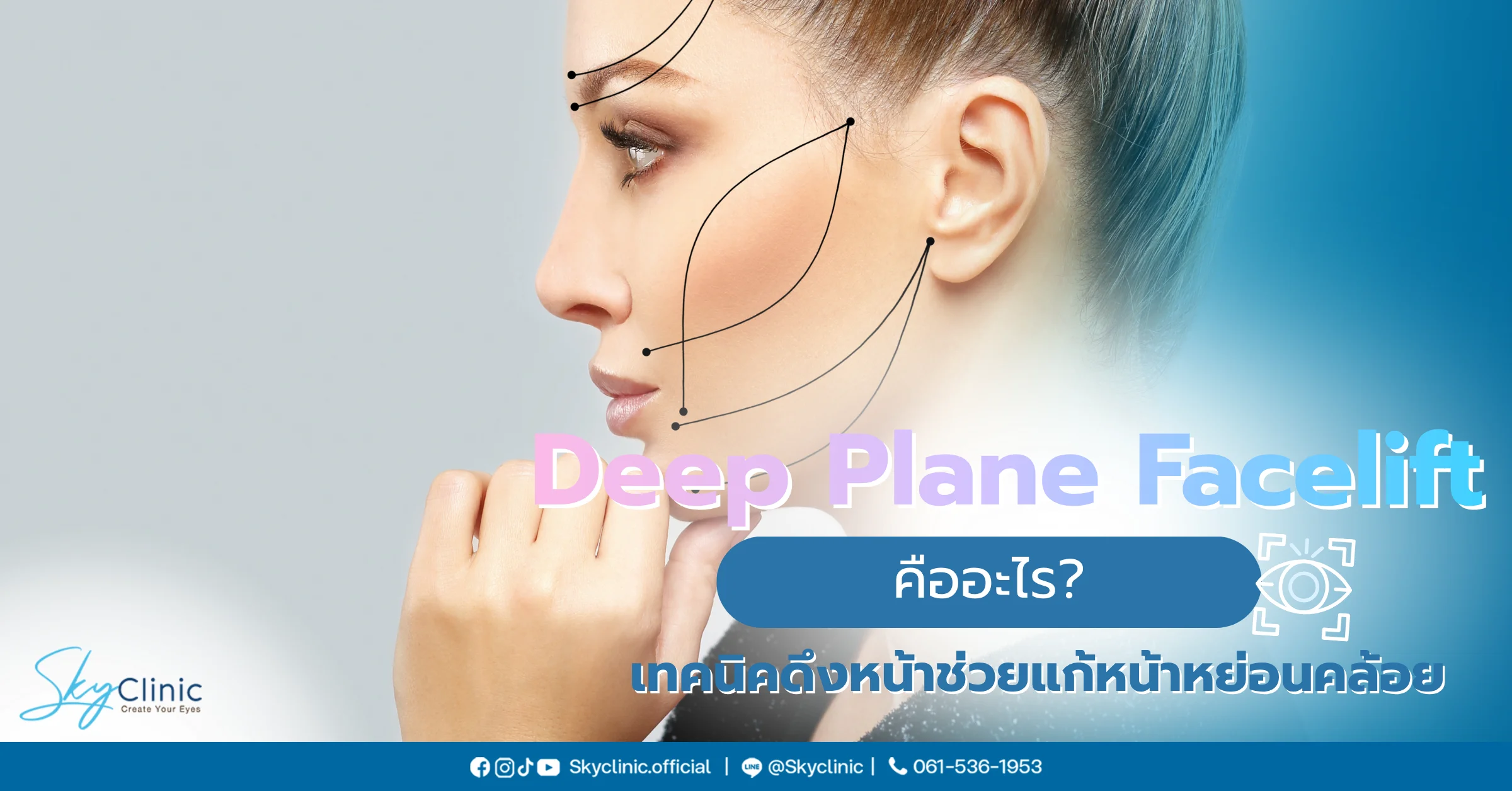 Deep Plane Facelift