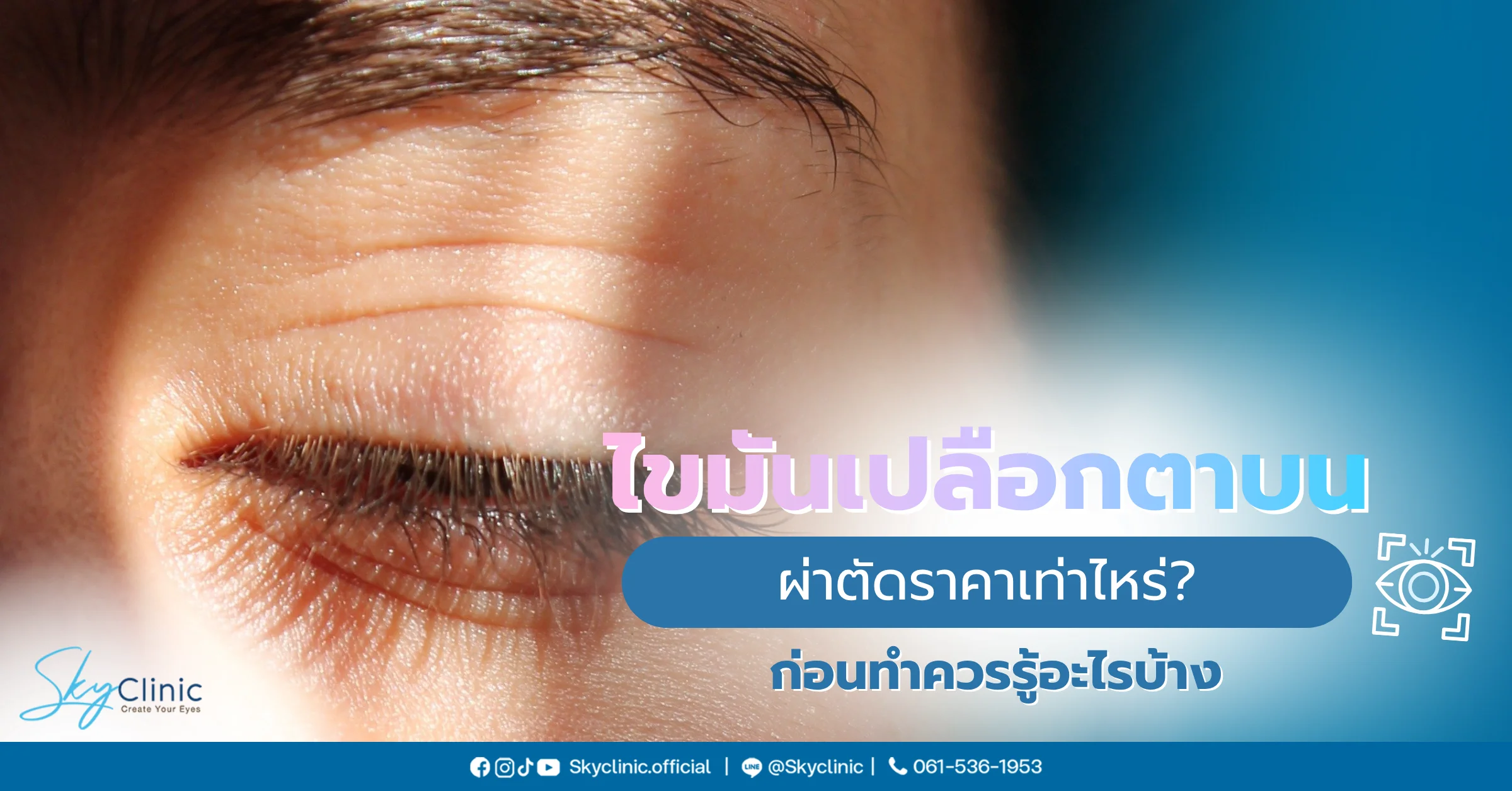 ไขมันเปลือกตาบน 
