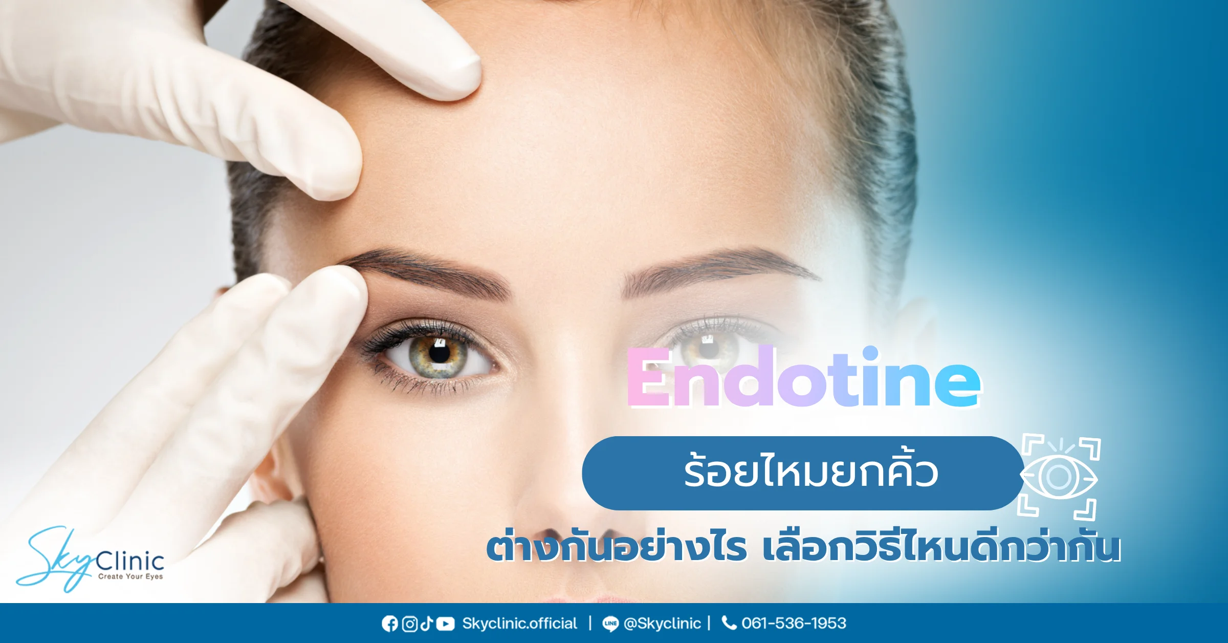 Endotine