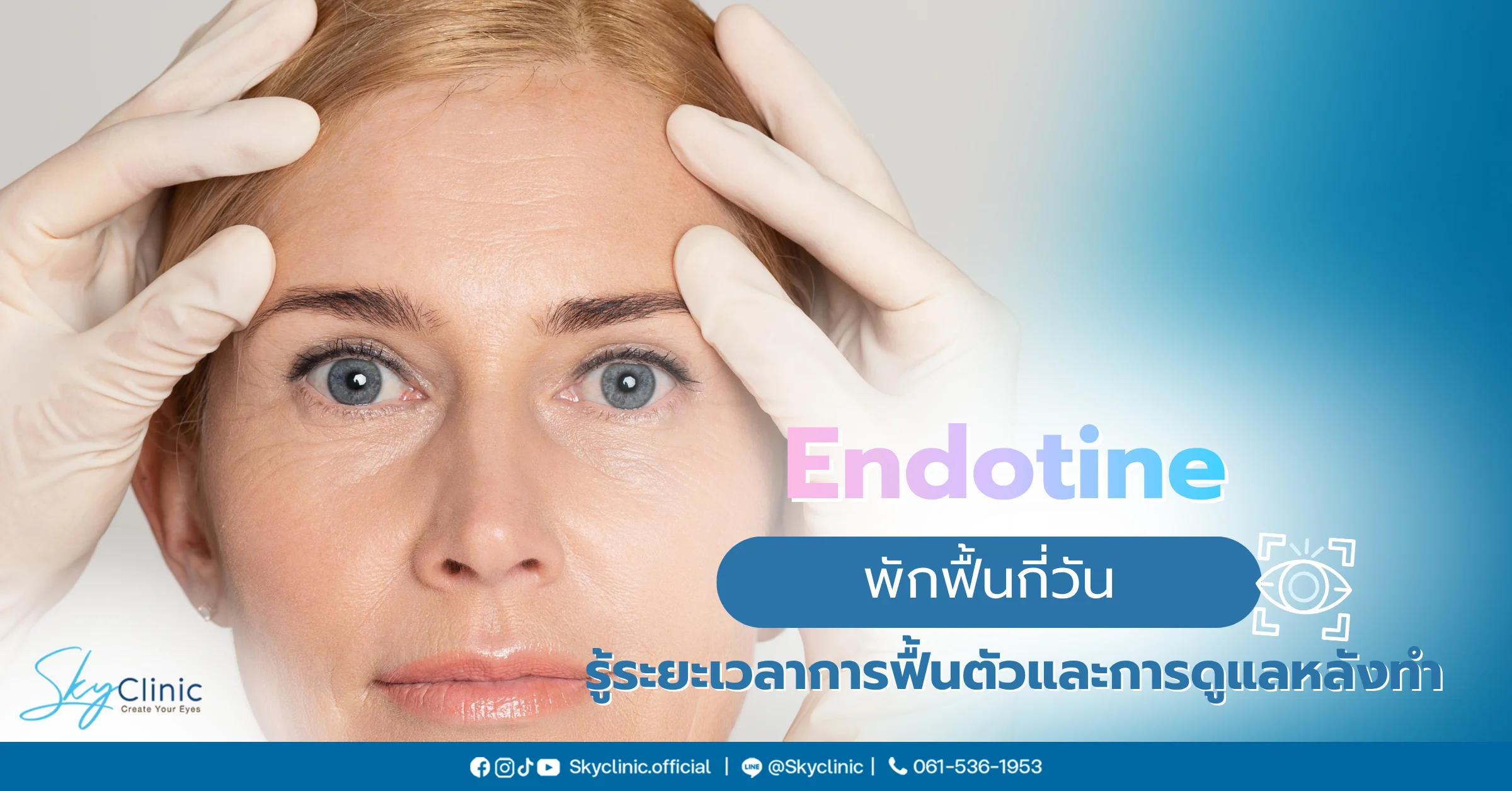 Endotine 
