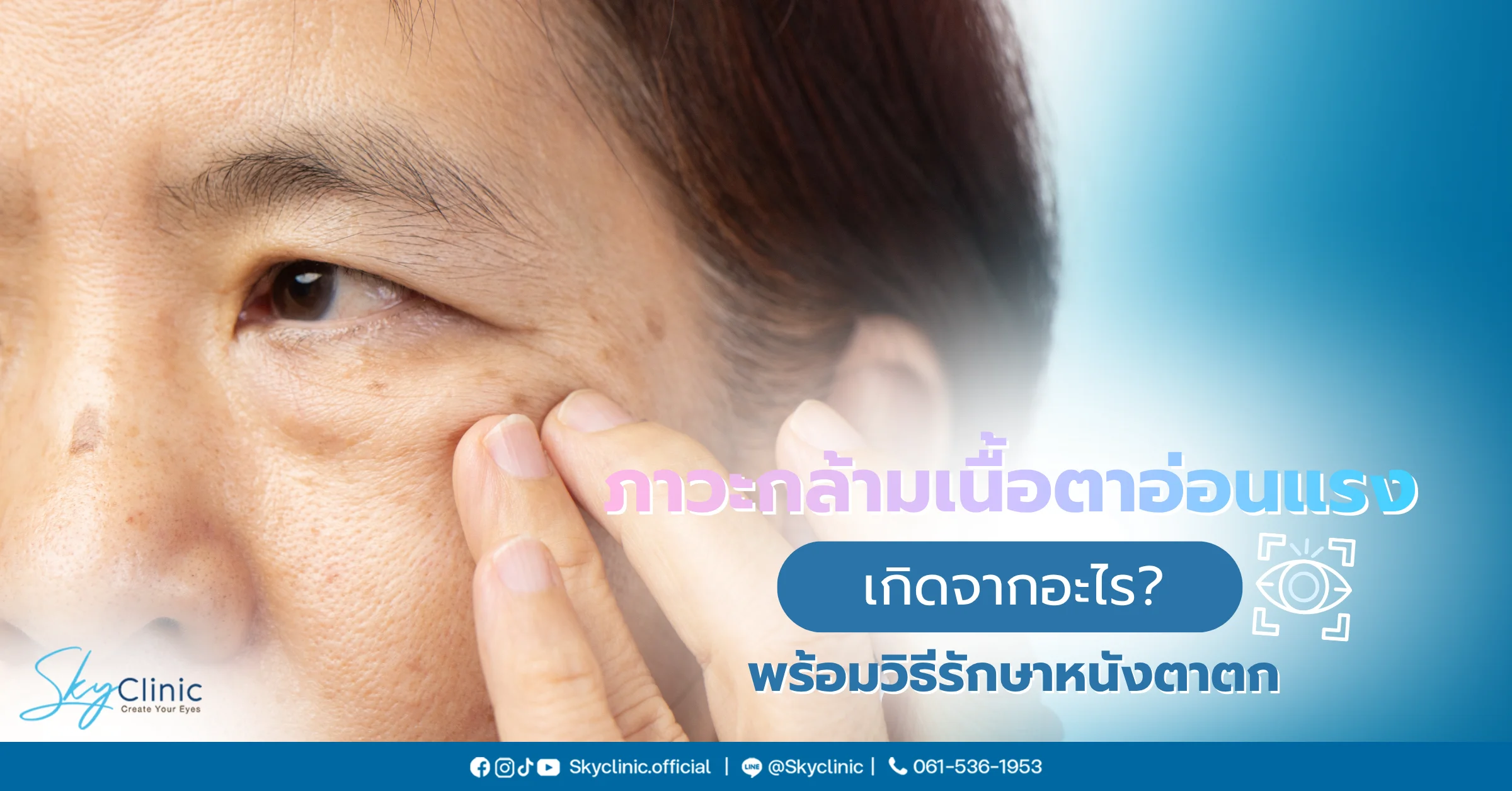 กล้ามเนื้อตาอ่อนแรง