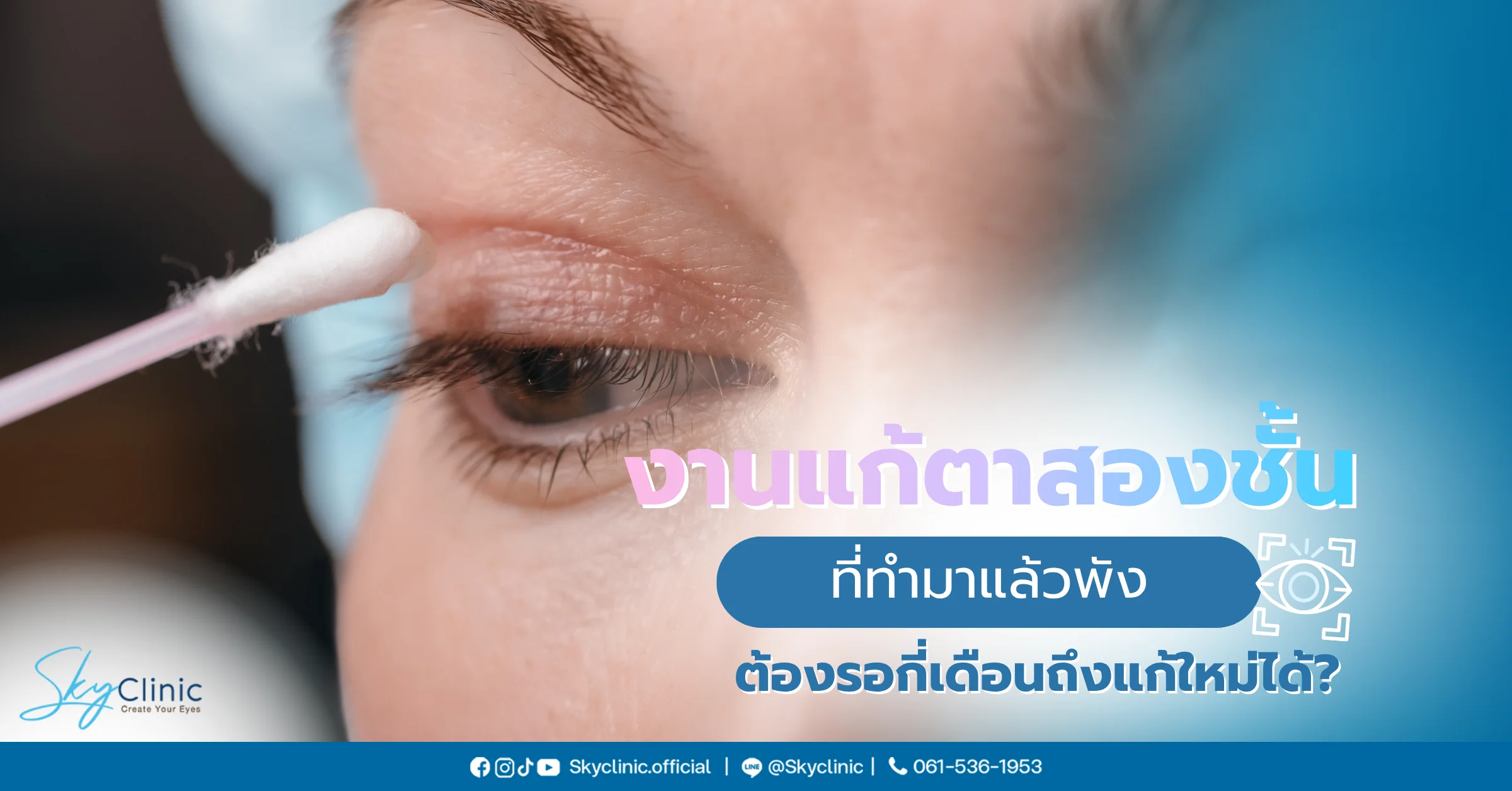 แก้ตาสองชั้นที่ทำมาแล้ว