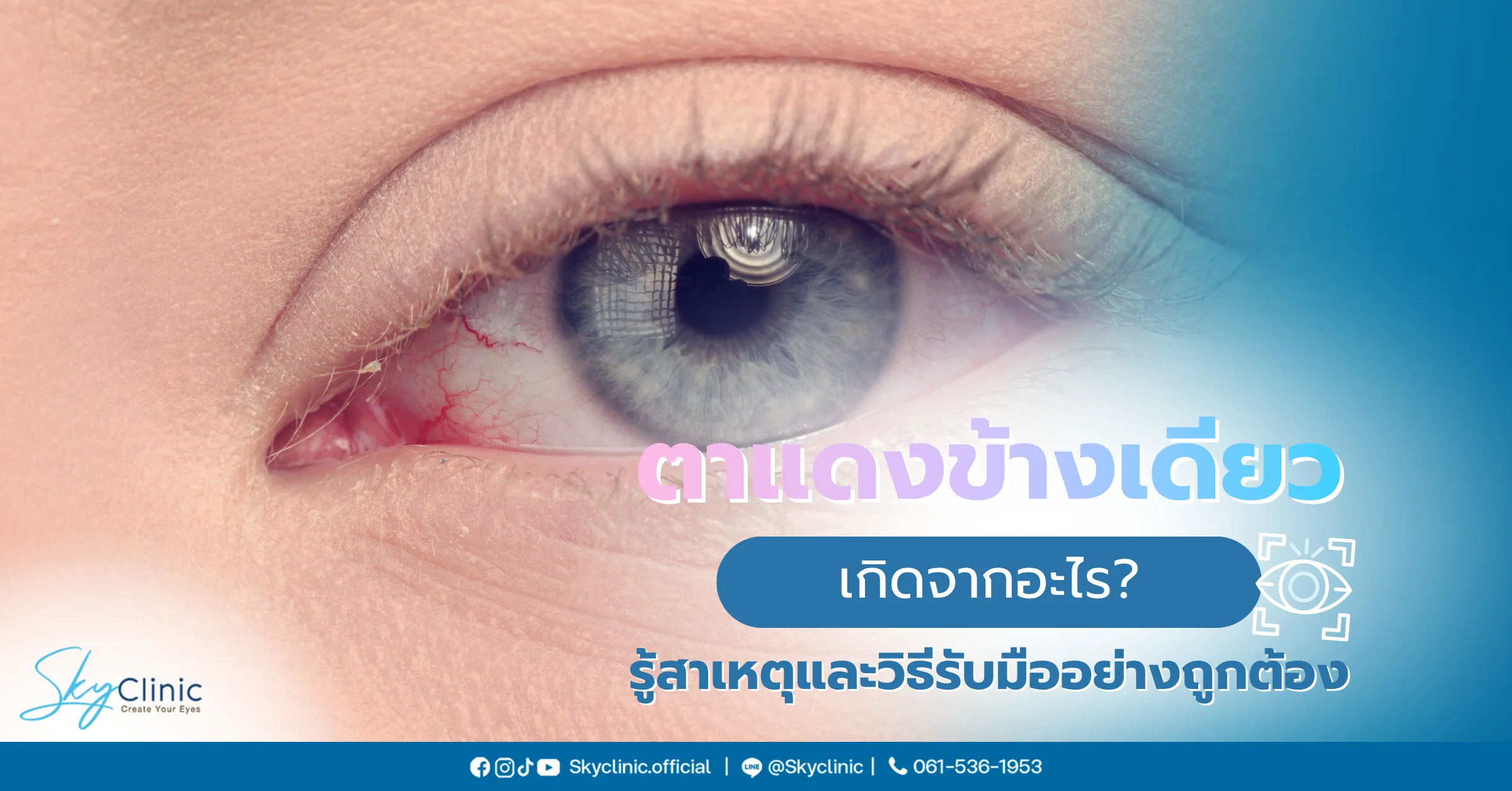 ตาแดงข้างเดียว เกิดจากอะไร? รู้สาเหตุและวิธีรับมืออย่างถูกต้อง