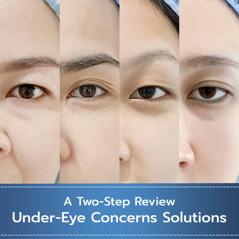 Reviews by Eye Concerns