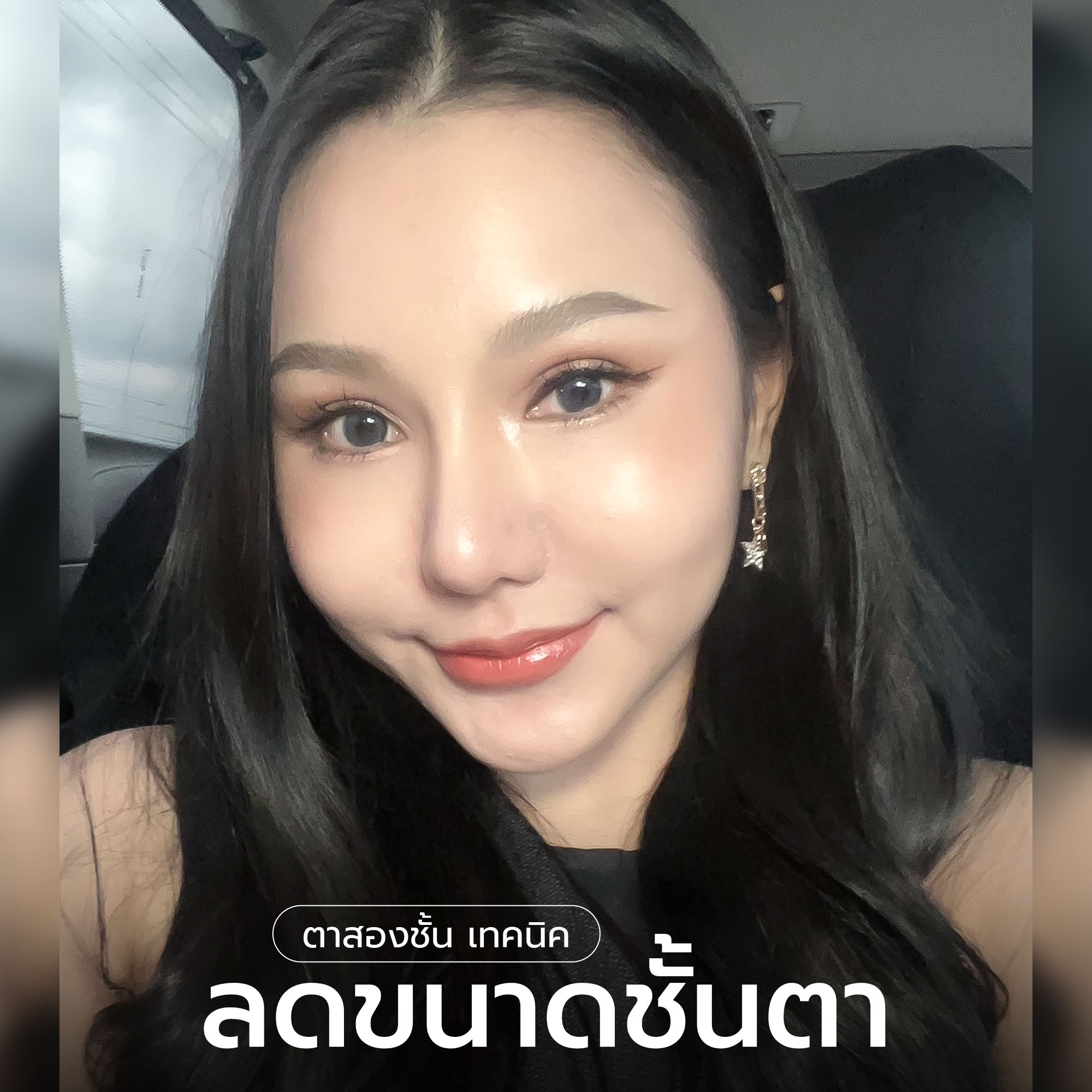 ลดขนาดชั้นตา