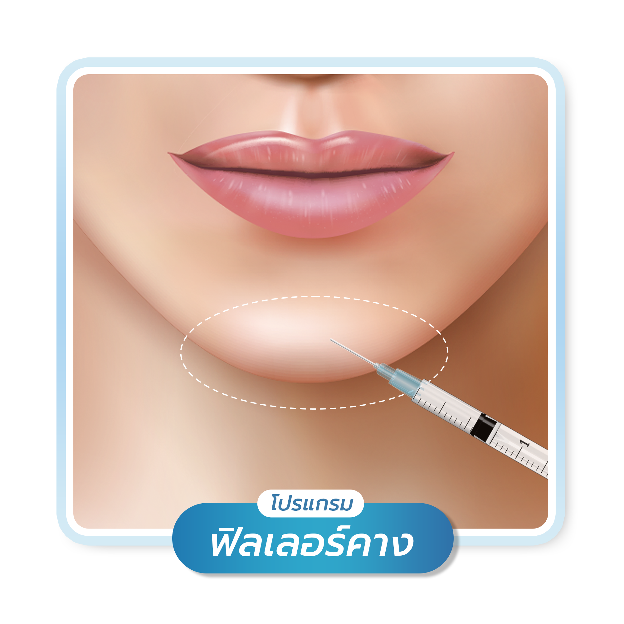 โปรแกรม ฟิลเลอร์คาง