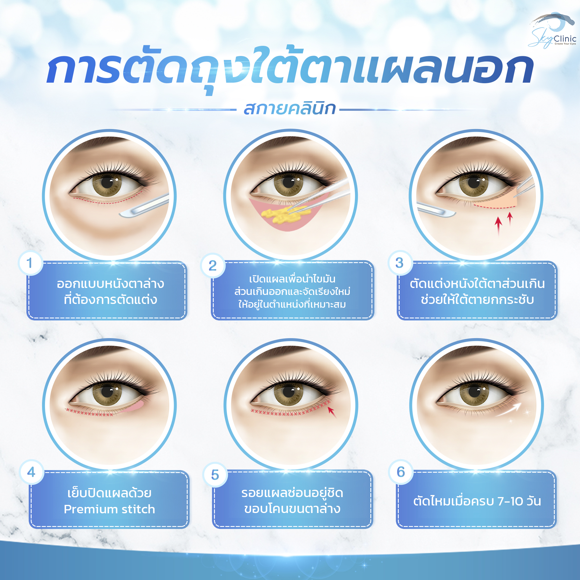 External Incision Under-Eye Surgery