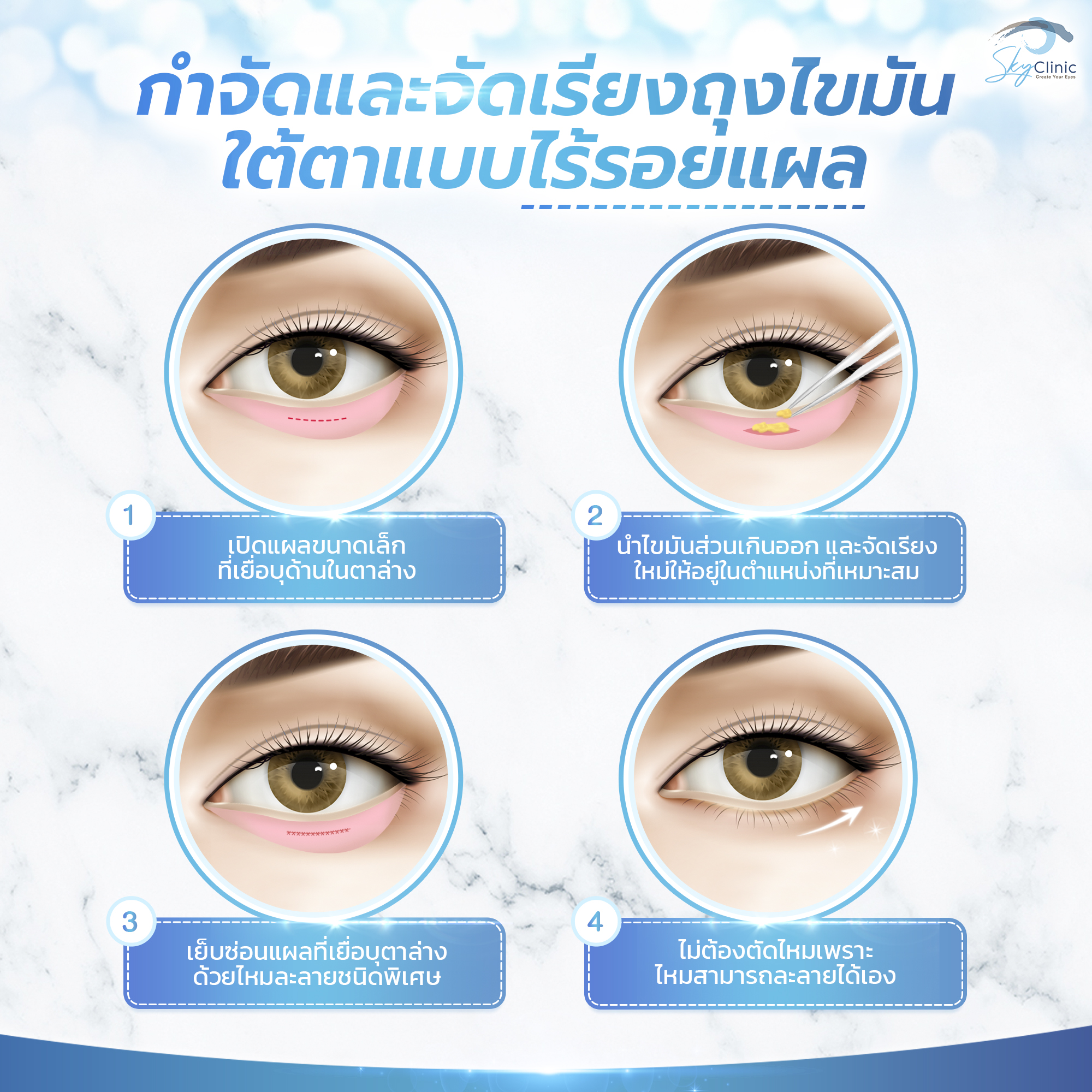 Scarless Under-Eye Surgery